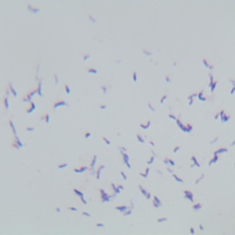 Mycobacterium tuberculosis-BNCC