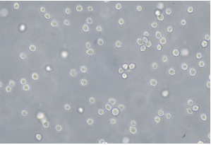 Trichomonas vaginalis Antigen Detection Reference Material (Chemical inactivation) (Strong Positive)-BNCC