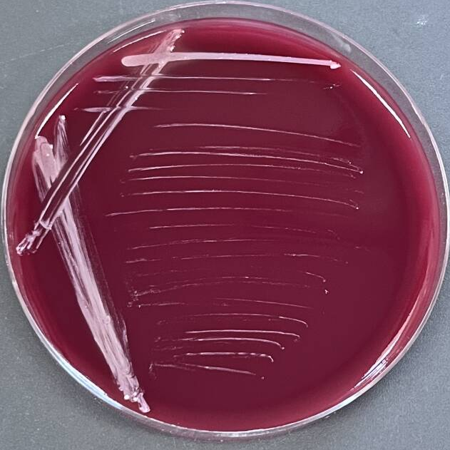 Actinomyces gonorrhoeae-BNCC