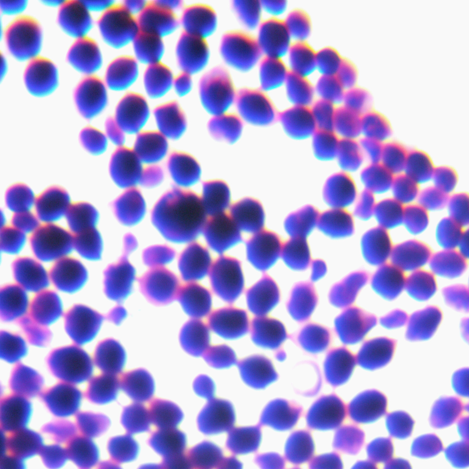 Cryptococcus vaginalis-BNCC