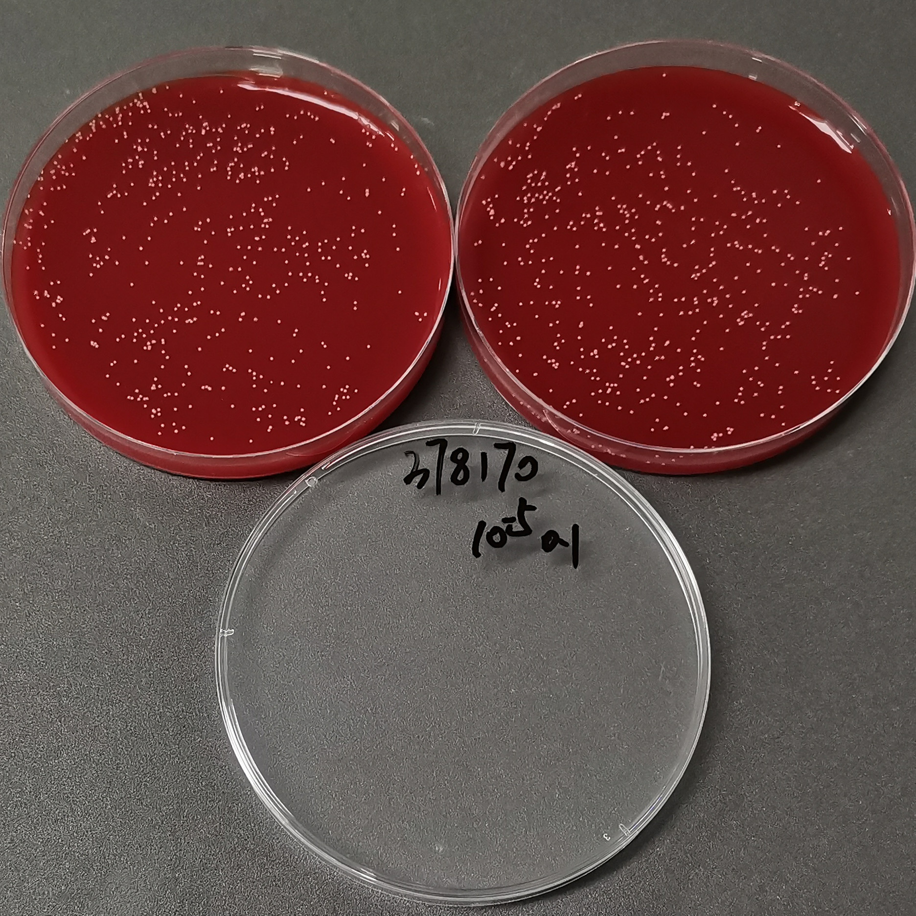 Human Brucella-BNCC
