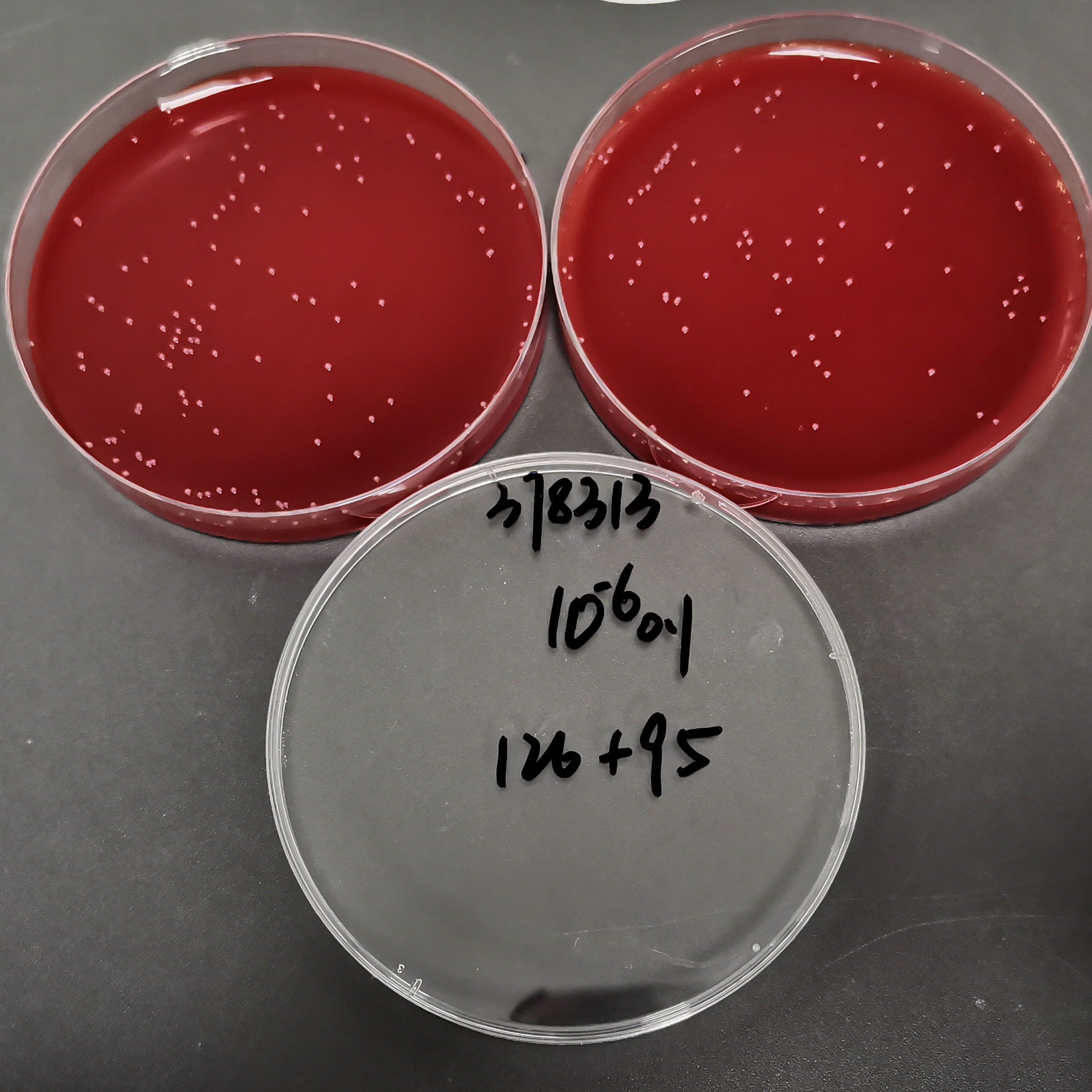 Listeria monocytogenes-BNCC
