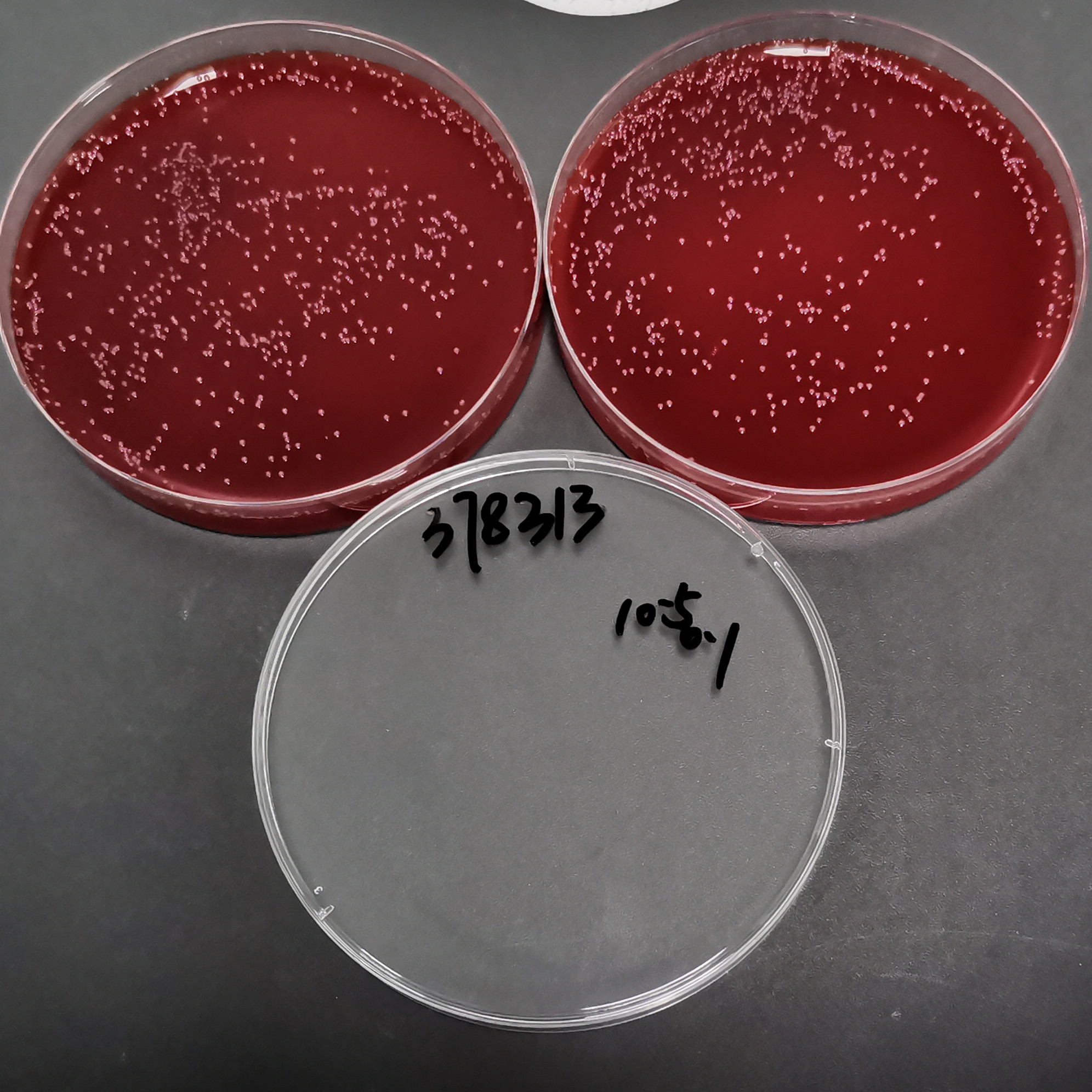Listeria monocytogenes-BNCC
