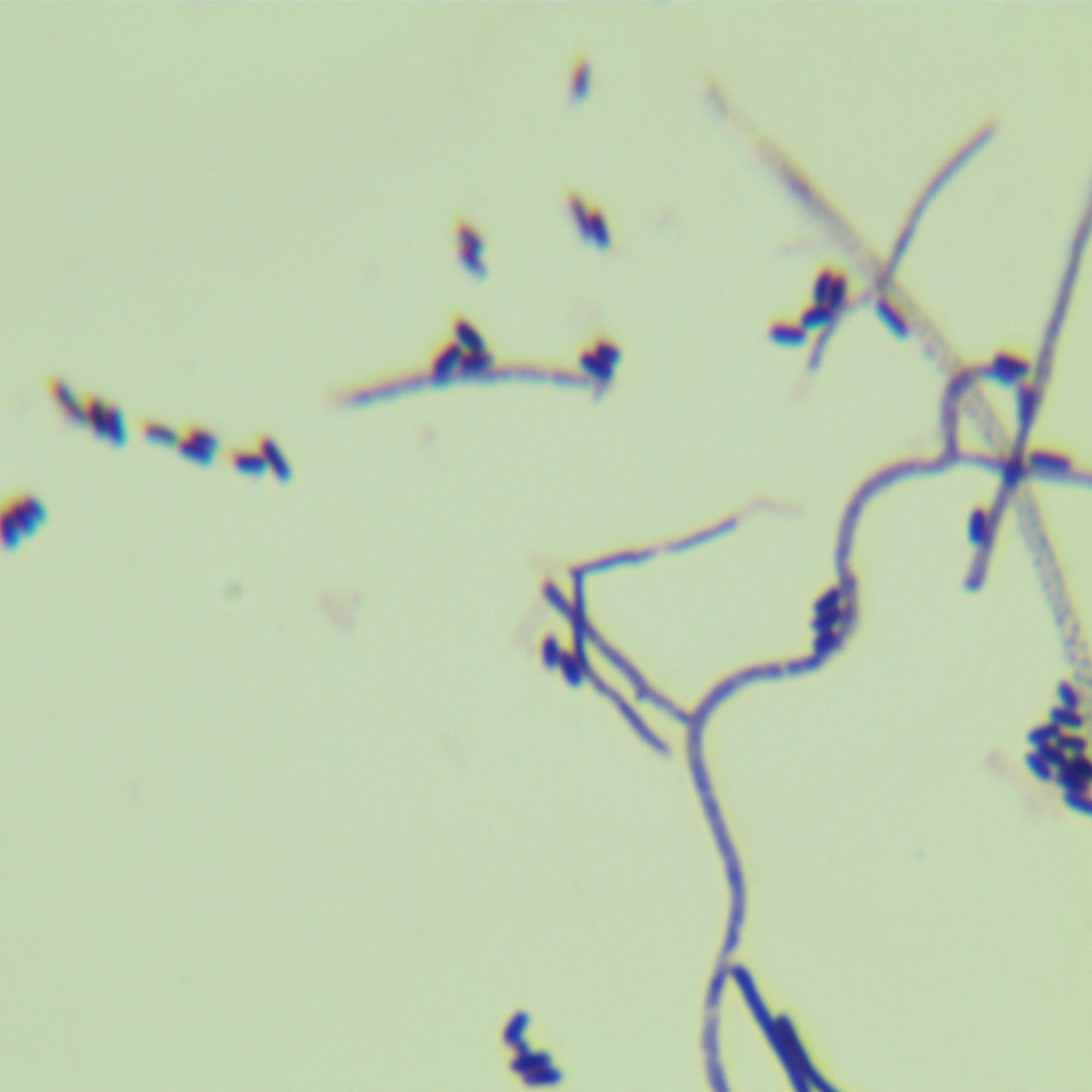 Streptomyces coelicolor-BNCC