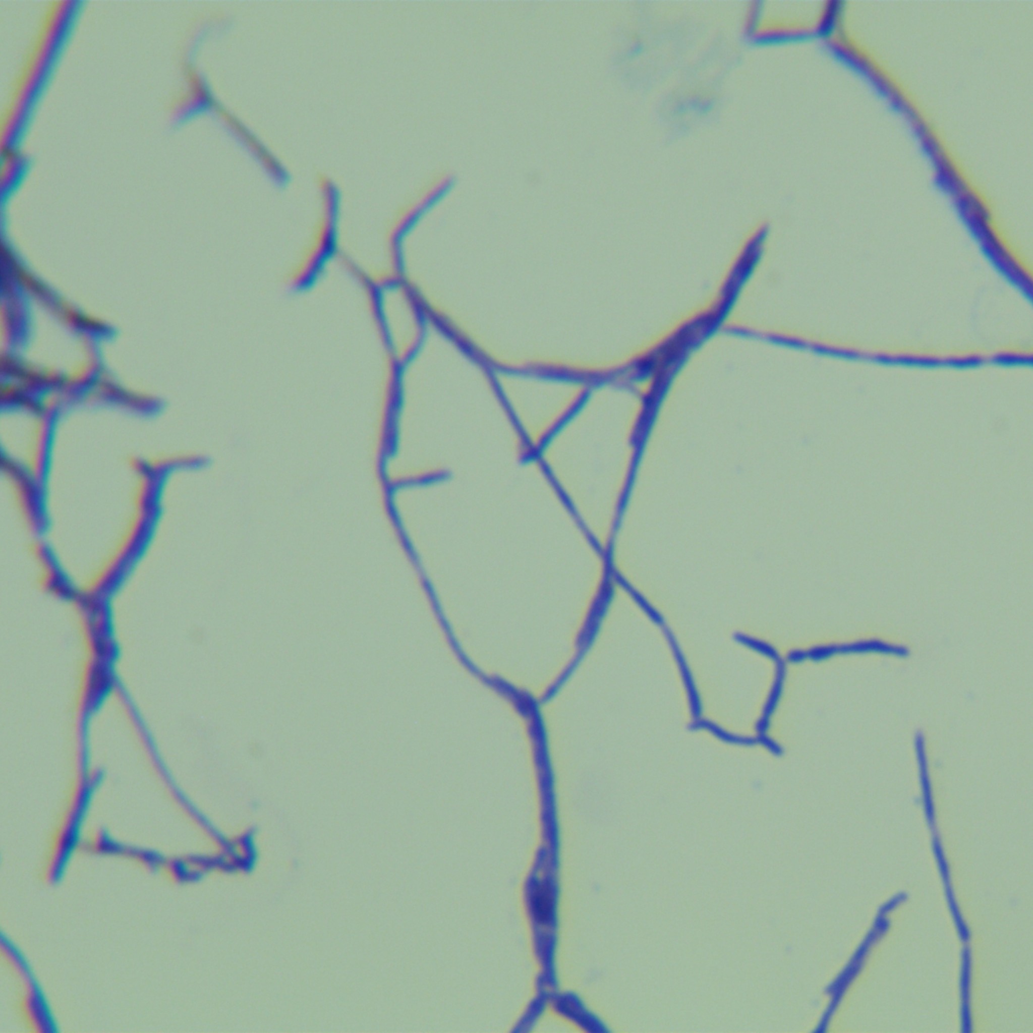 Glycopeptidomycin mimicking Acinetobacter baumannii-BNCC