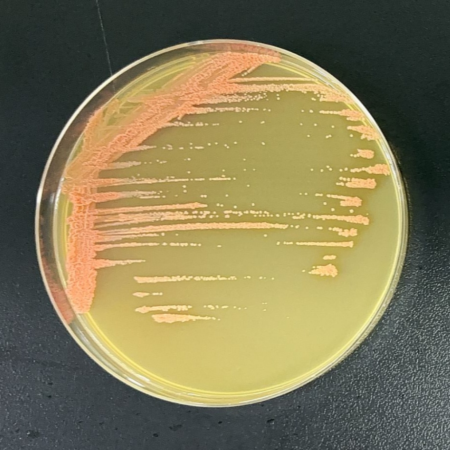 Glycopeptidomycin mimicking Acinetobacter baumannii-BNCC