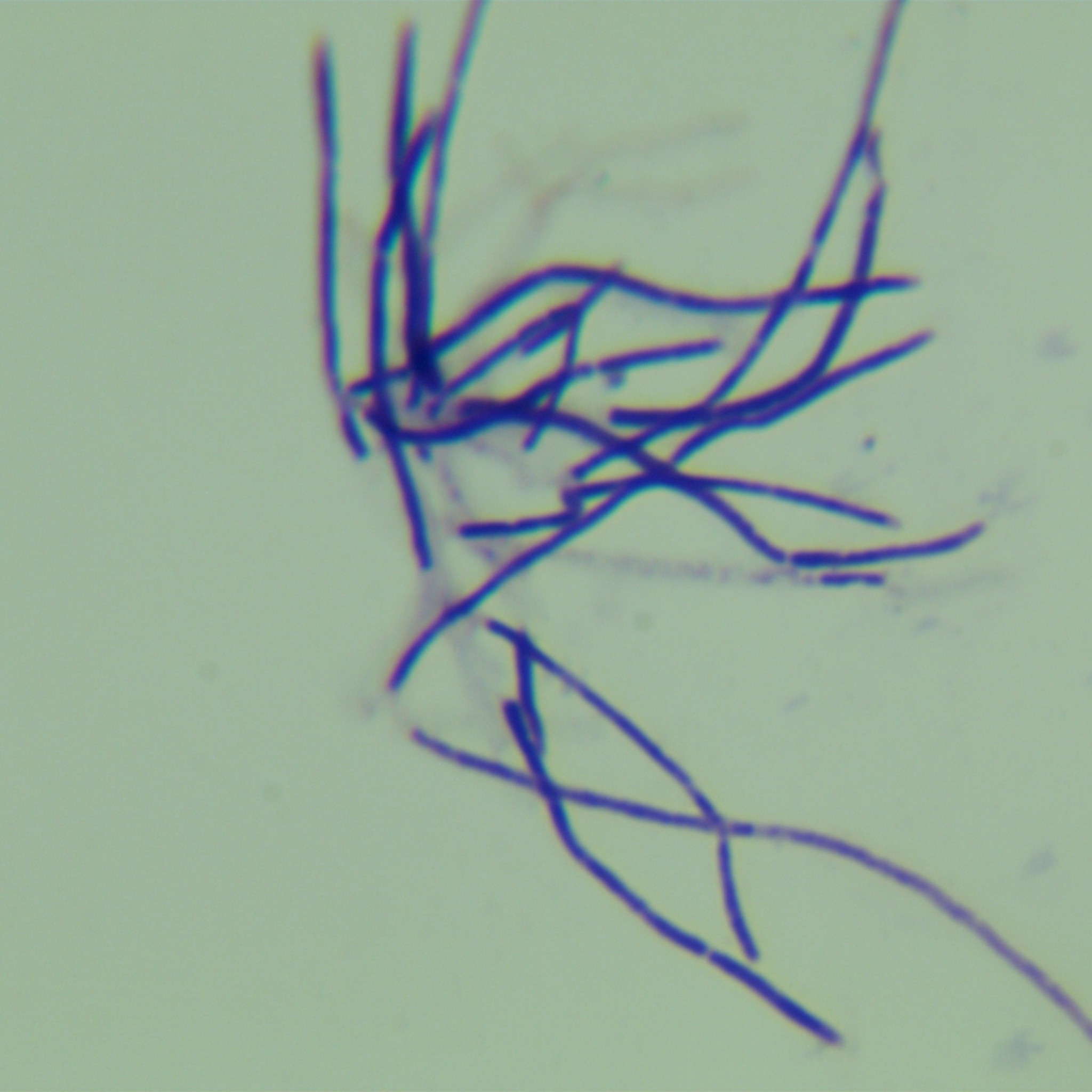 Streptomyces spinneretics-BNCC