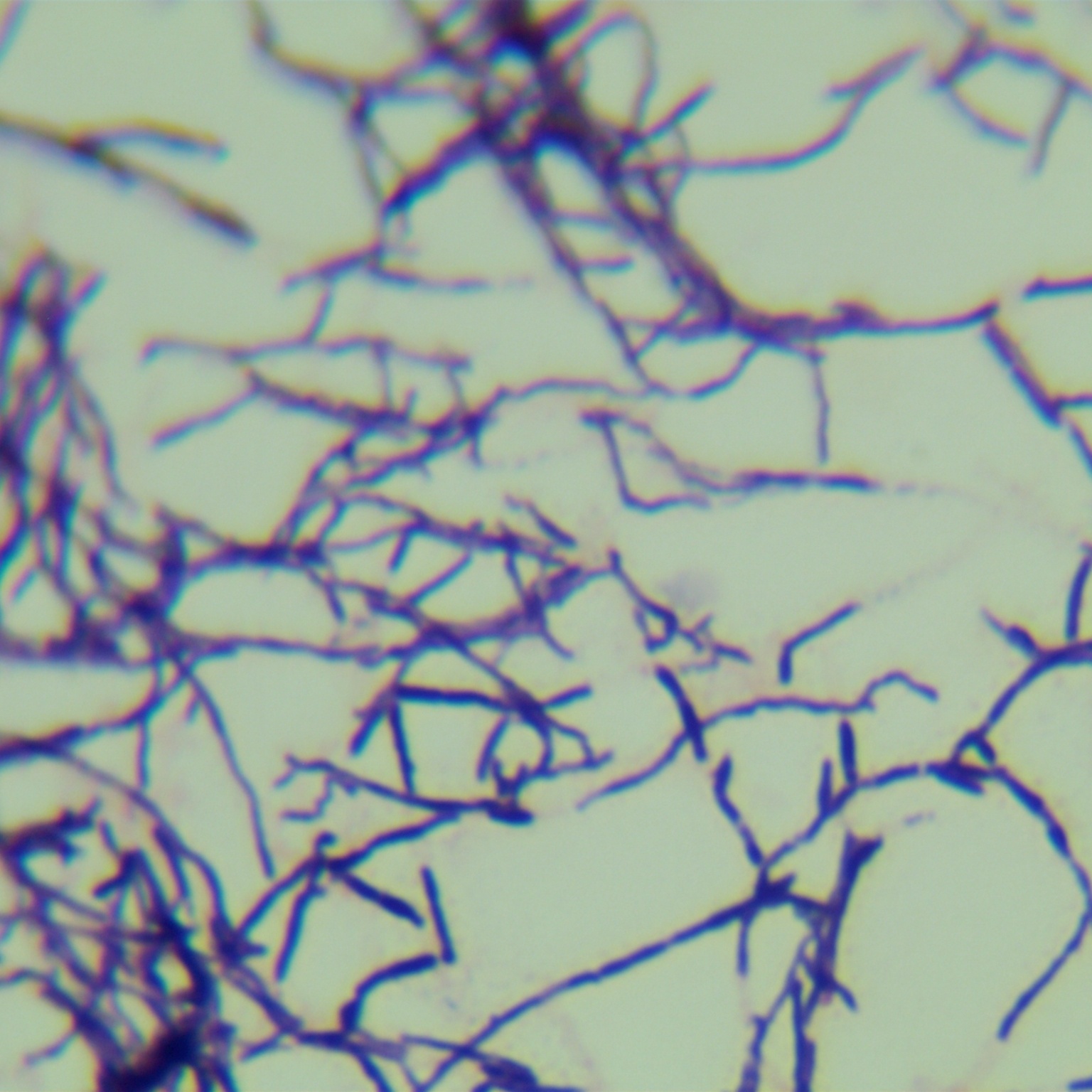 Algal plant actinomycetes-BNCC