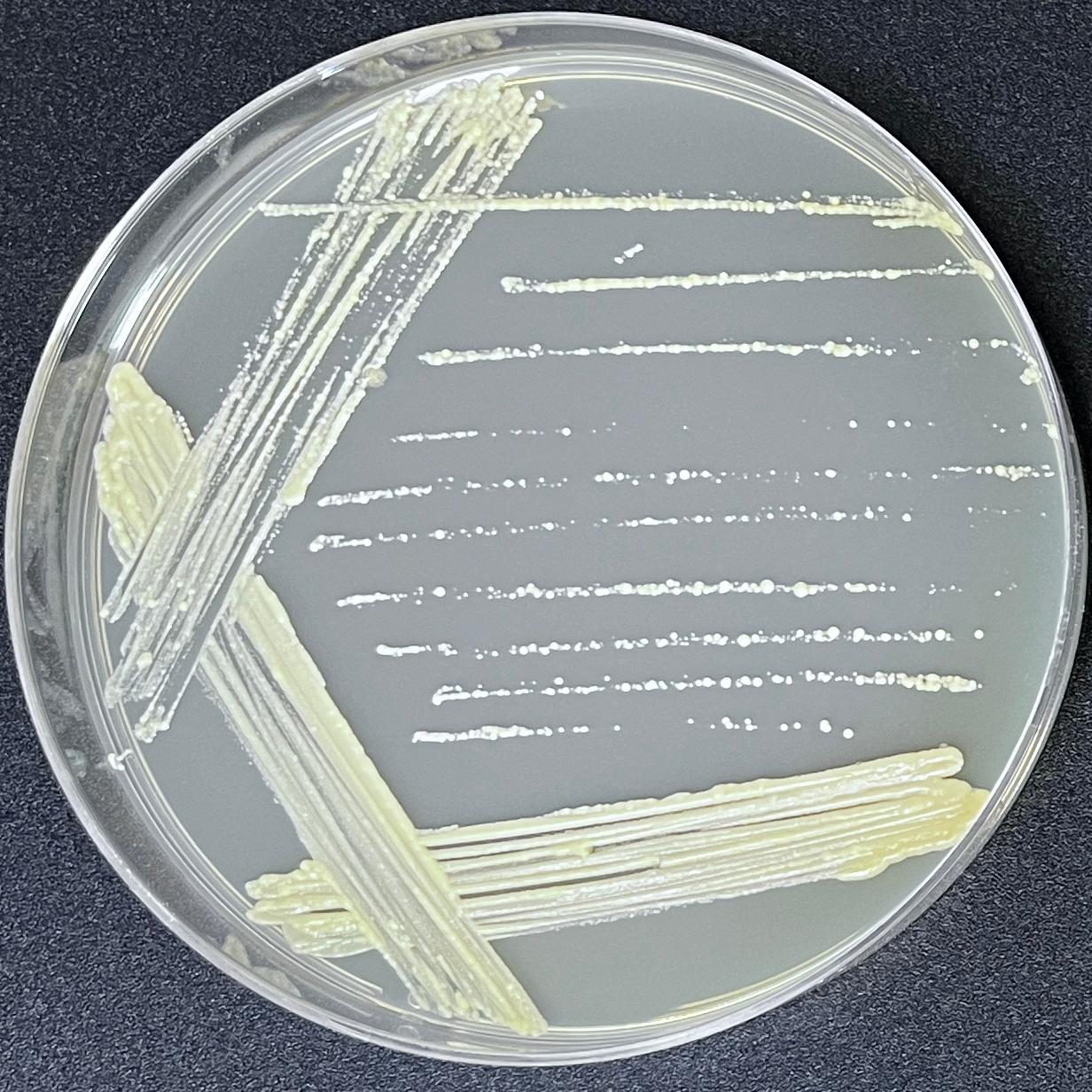Mycobacterium genus-BNCC