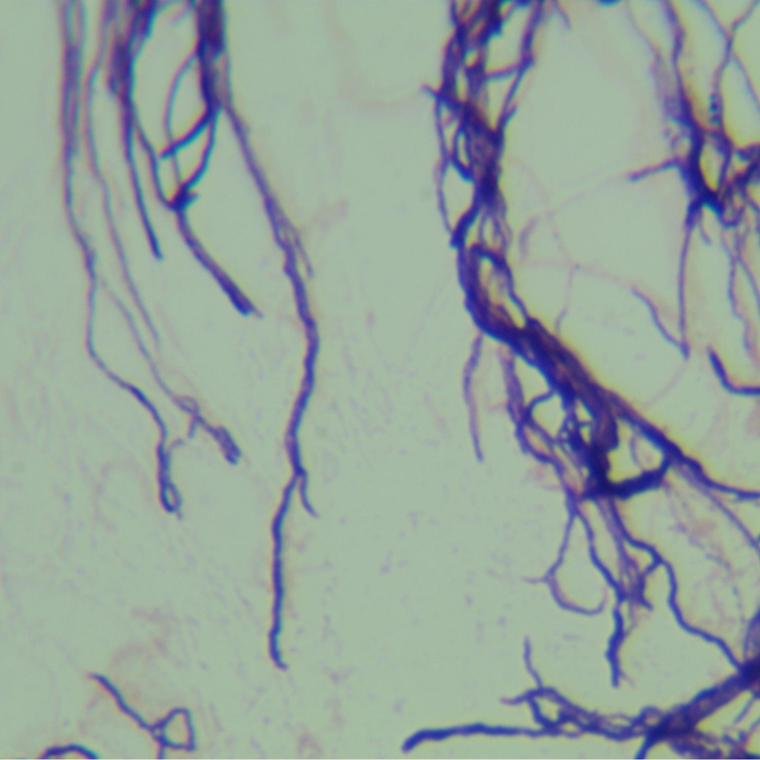 Streptomyces peucetius subsp. caesius Arcamone et al.-BNCC