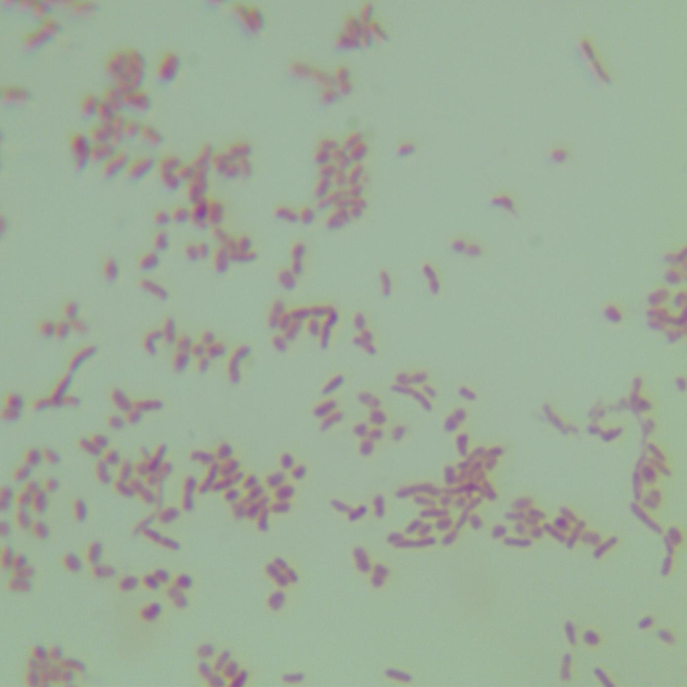Pseudomonas aeruginosa-BNCC