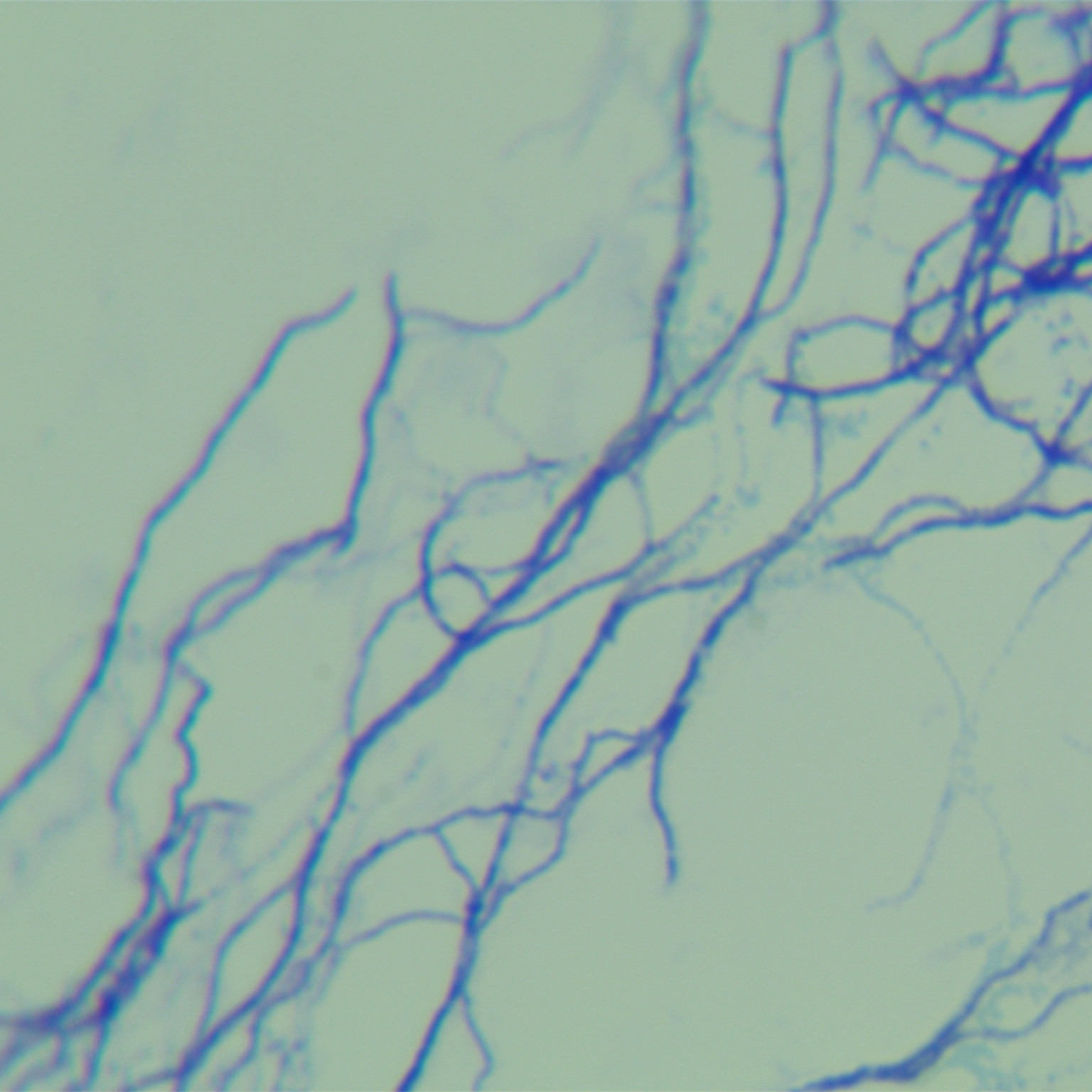 Actinobacteria genus-BNCC