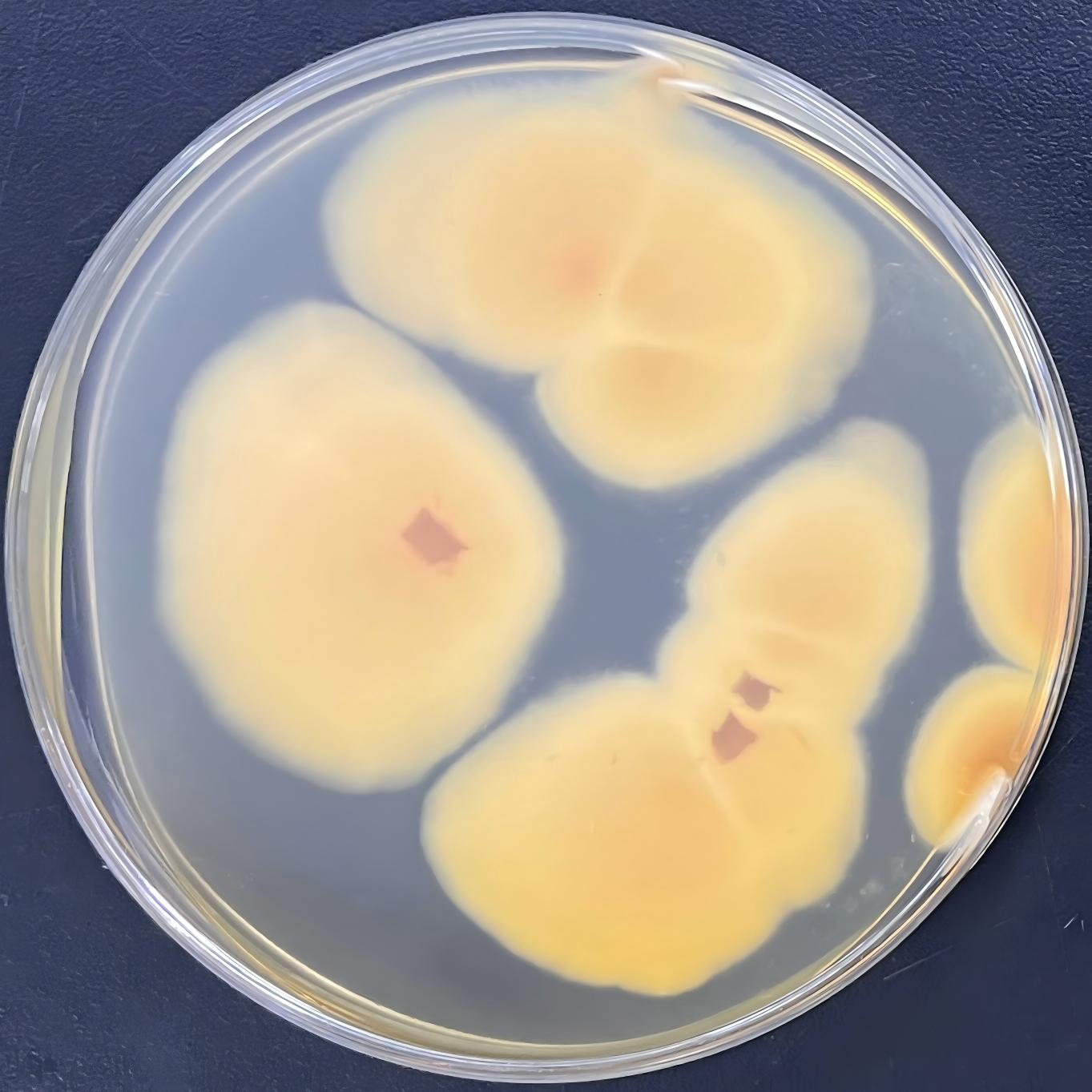 Thermophilic calcium spore fungus-BNCC
