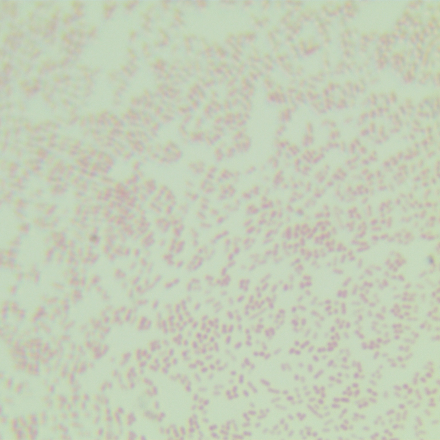 Hoylesella oralis-BNCC