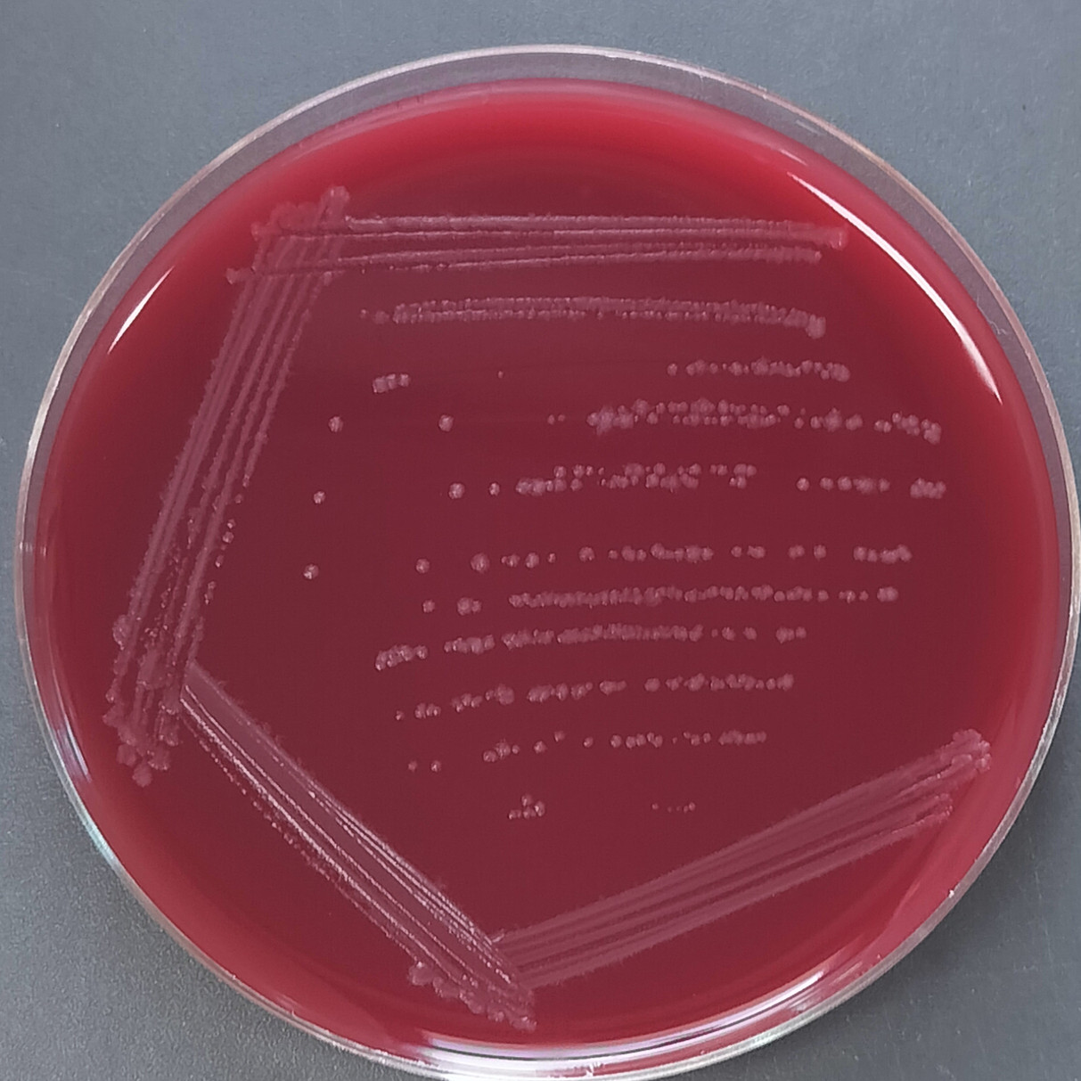 Difficult Clostridium difficile-BNCC