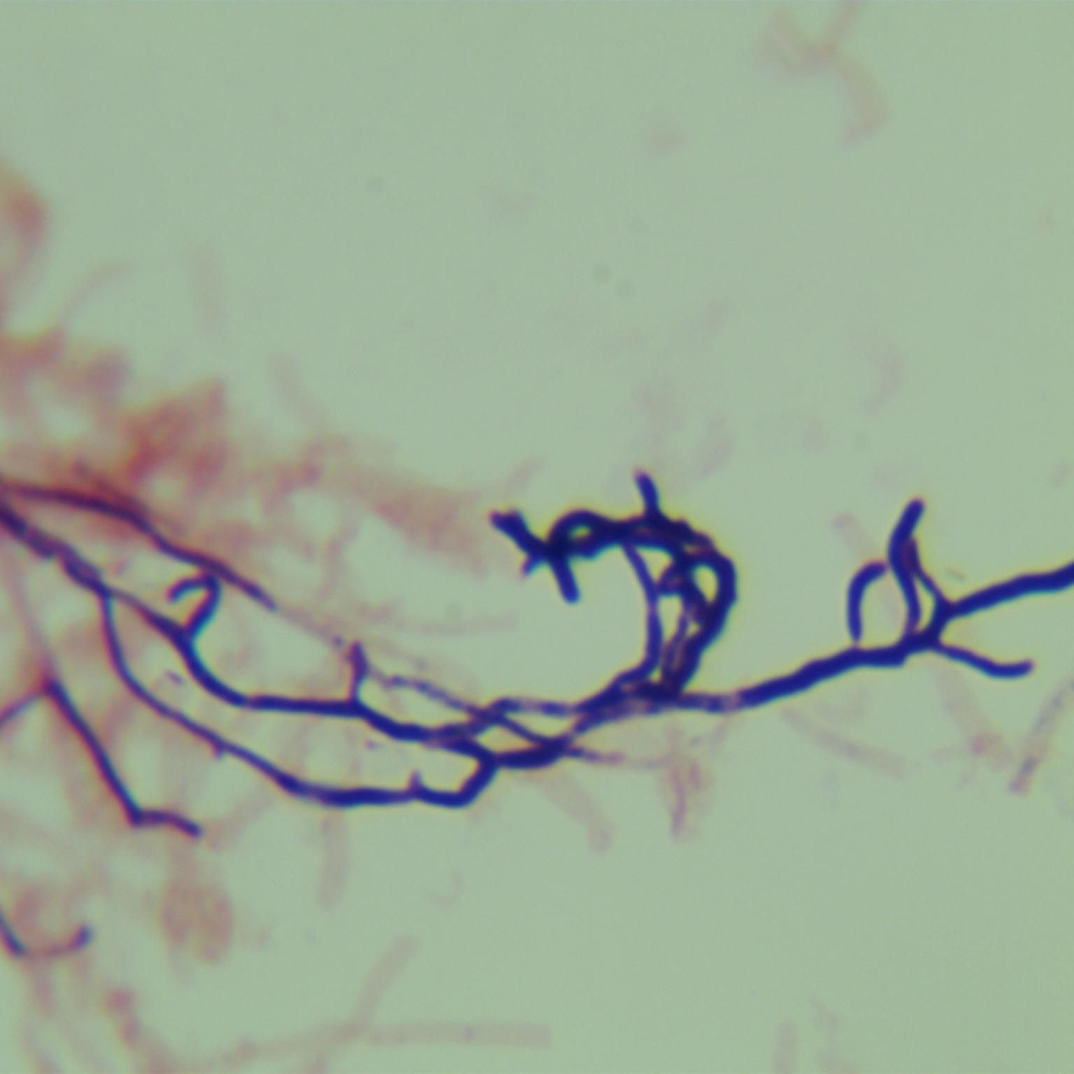 Lavender Grey Streptomyces-BNCC