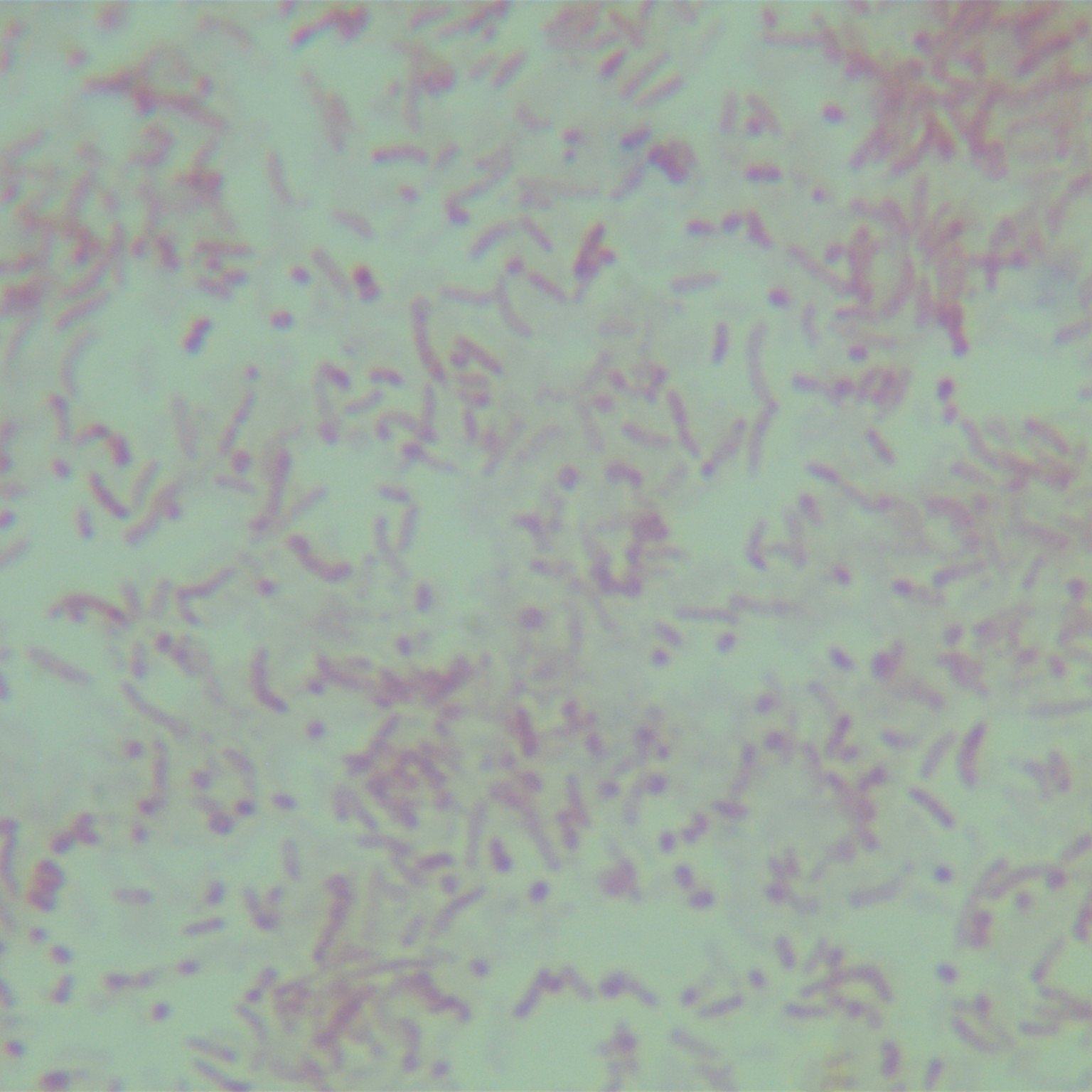 Desnitrosomonas-BNCC