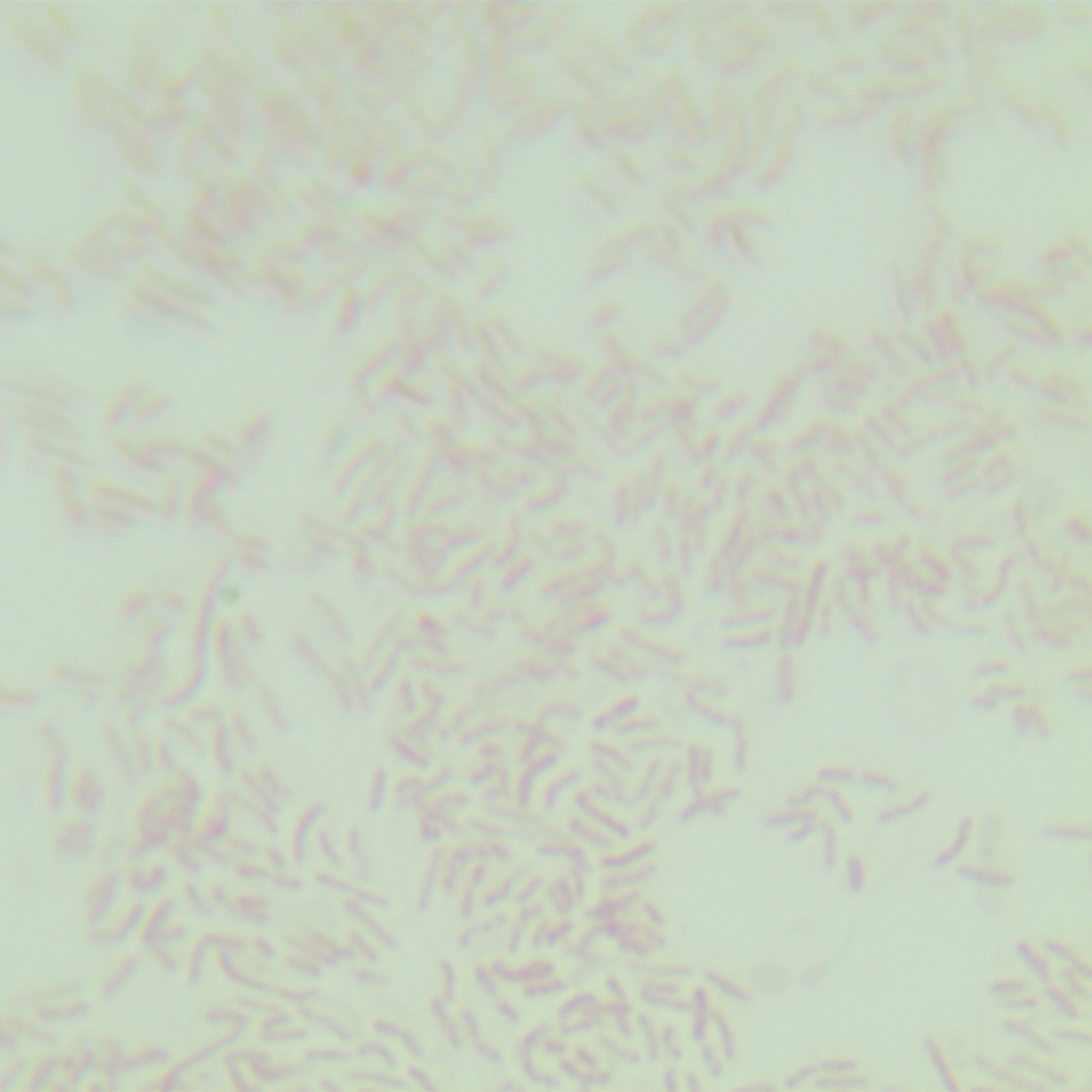 Japanese Shigella-BNCC