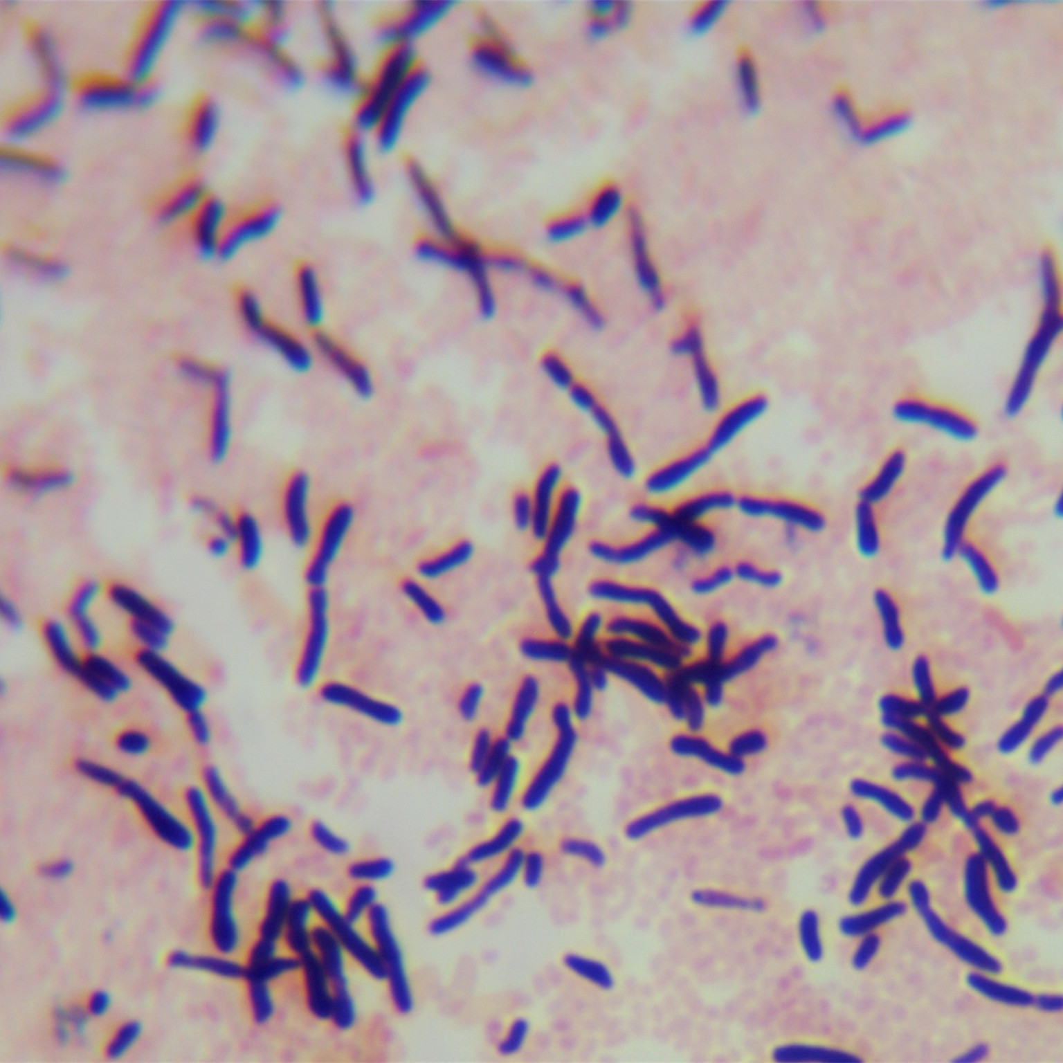Bacillus cereus-BNCC