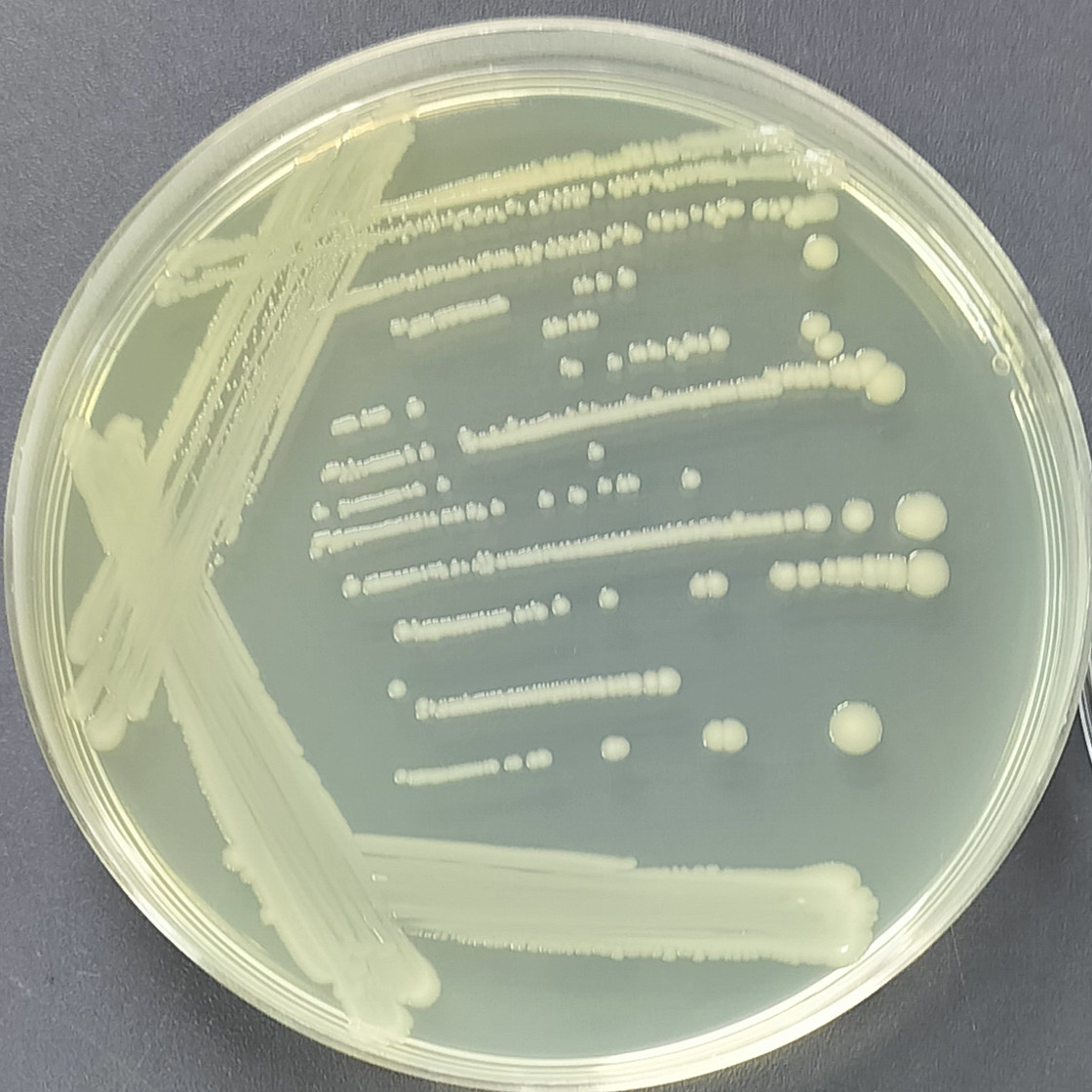 Escherichia coli-BNCC