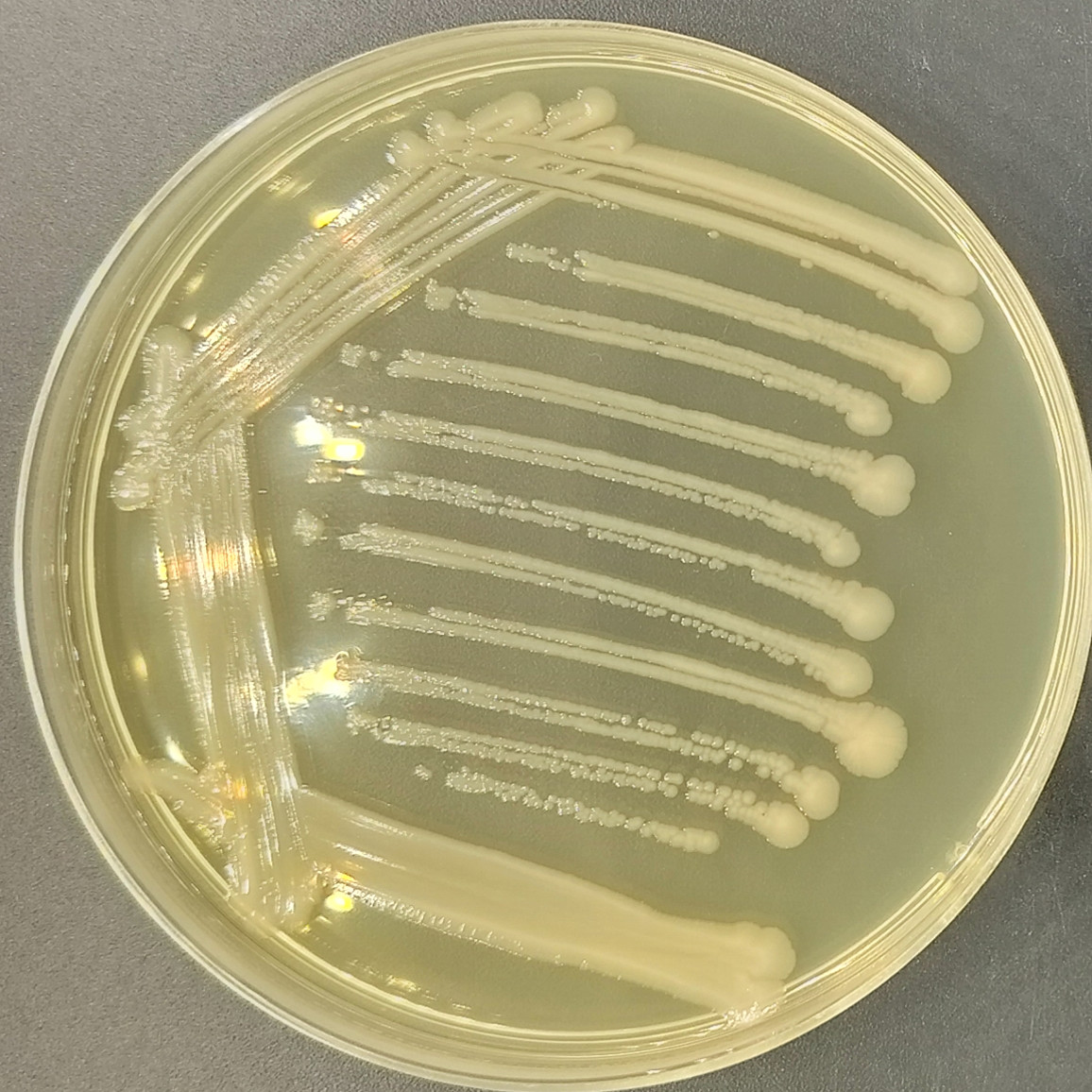 Escherichia coli-BNCC