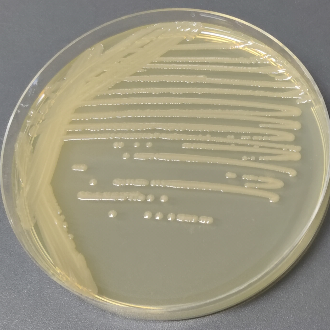Pseudomonas aeruginosa-BNCC