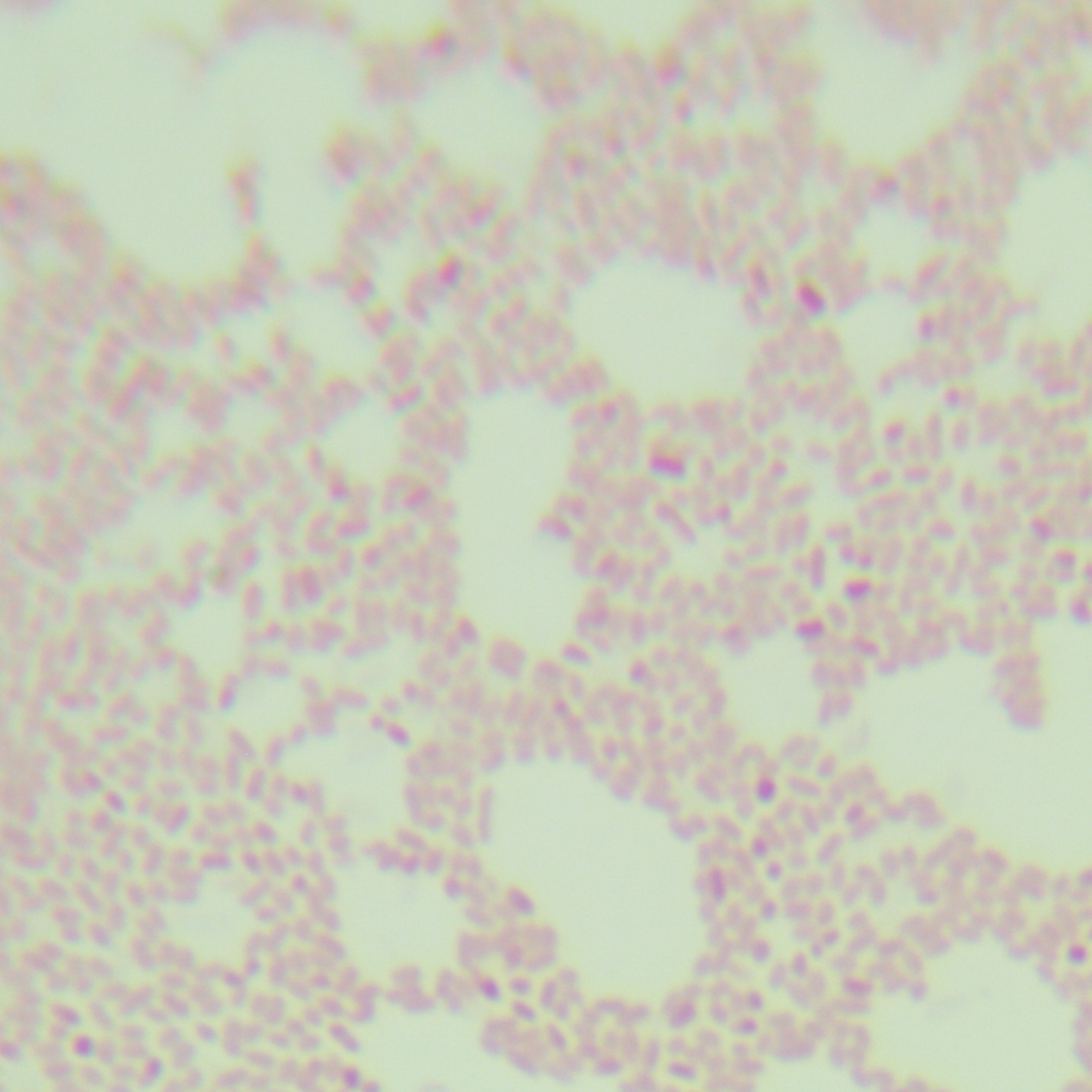 Pseudomonas aeruginosa-BNCC