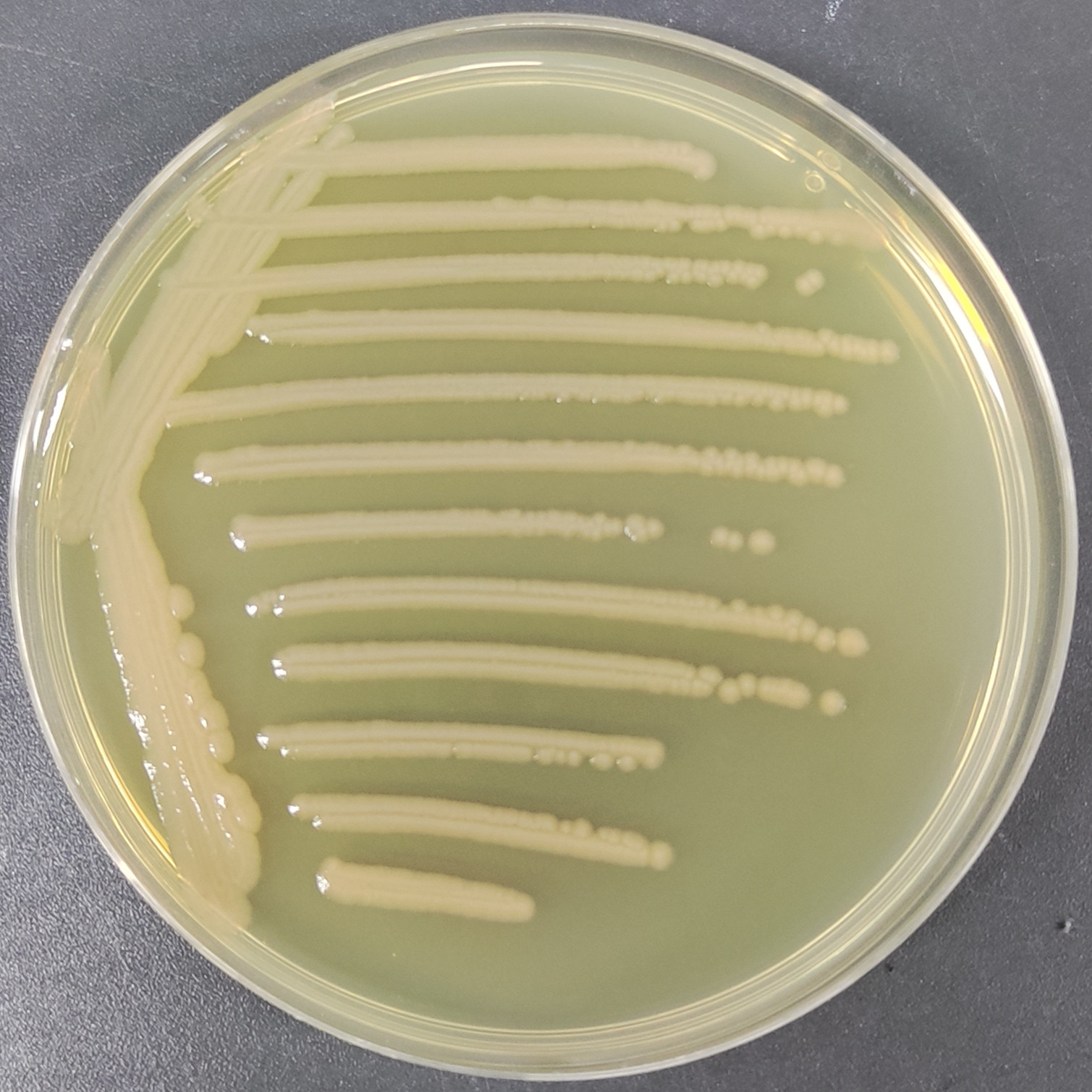 Pseudomonas aeruginosa-BNCC