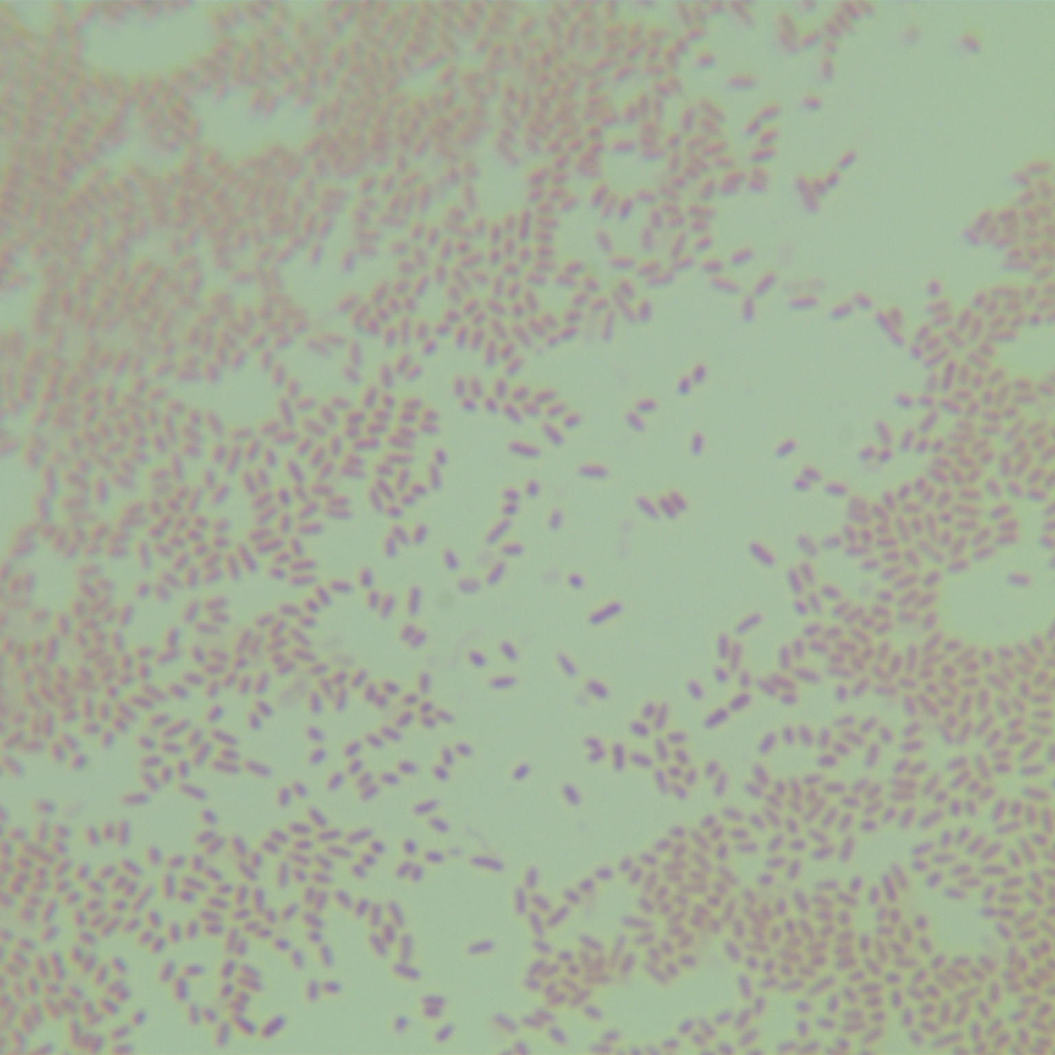 Pseudomonas aeruginosa-BNCC