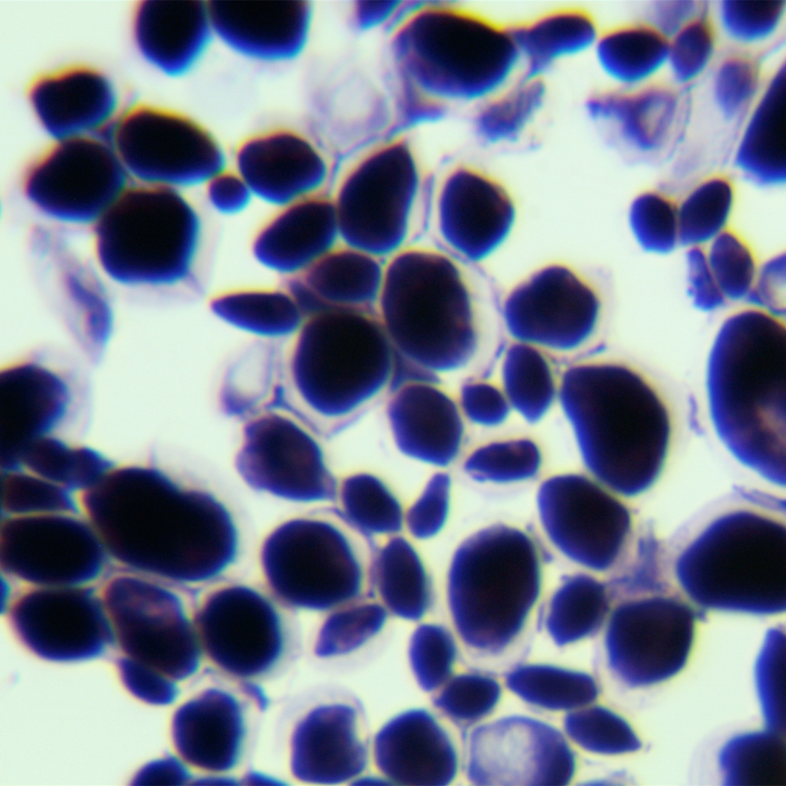 Melanogenic short stem fungus-BNCC