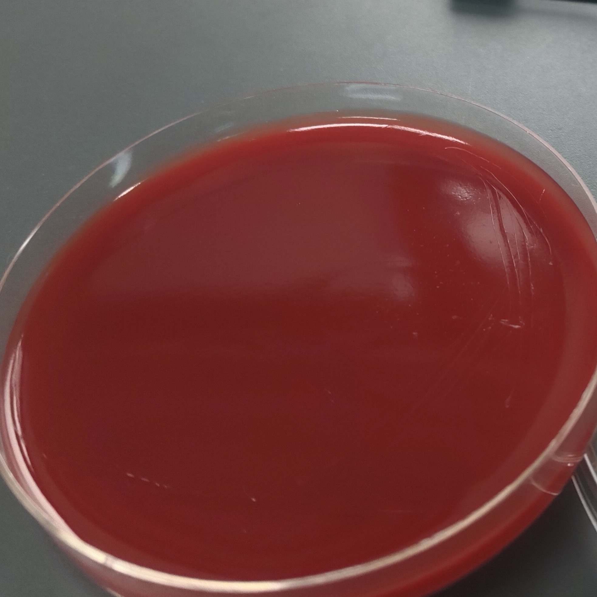 Wolbachia cholerae-BNCC