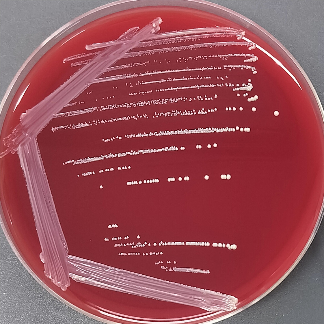 Propionibacterium genus-BNCC