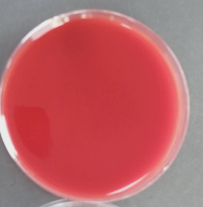 Gardnerella vaginalis Reference Material (Chemical inactivation) (Strong Positive)-BNCC