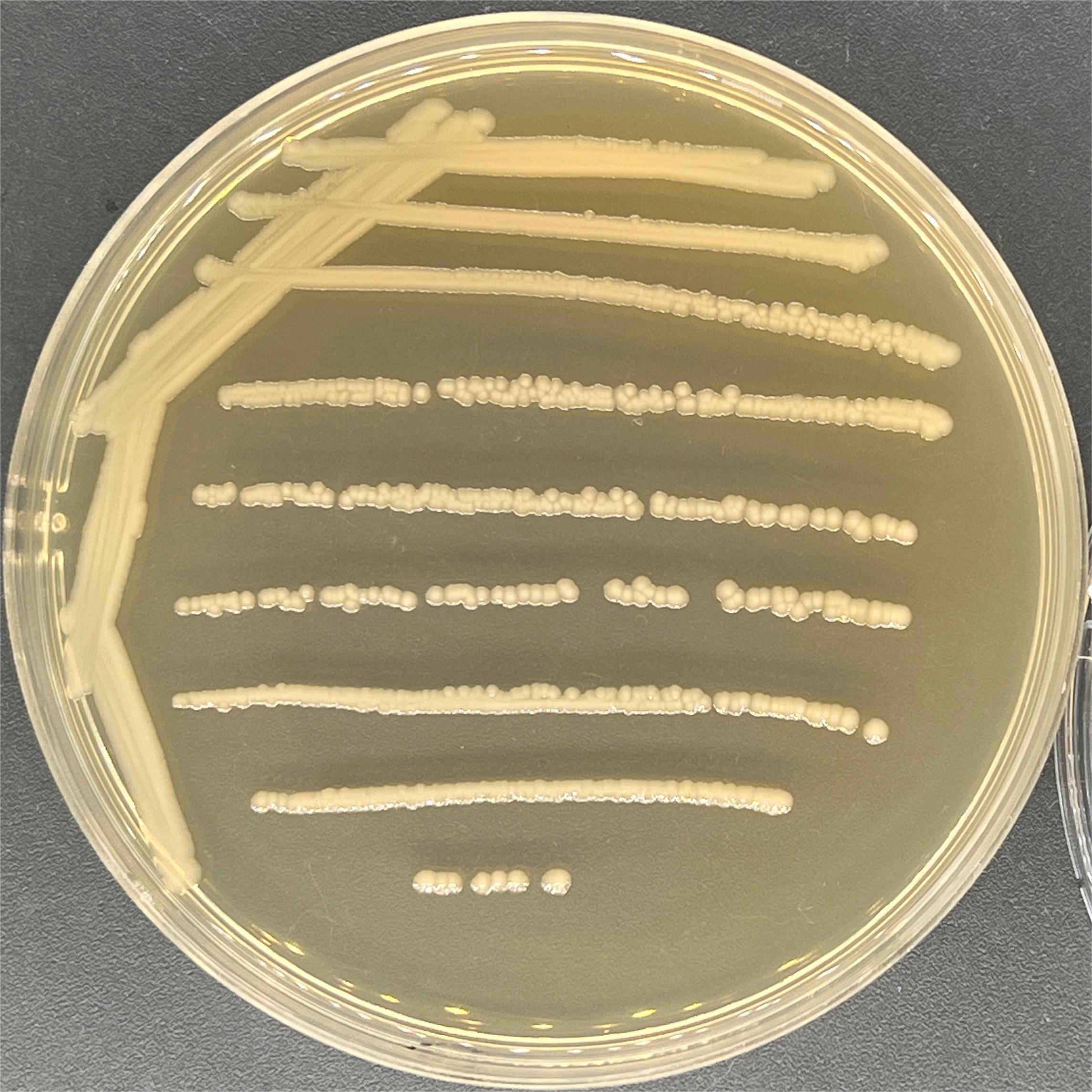 Enterotoxigenic Escherichia coli-BNCC