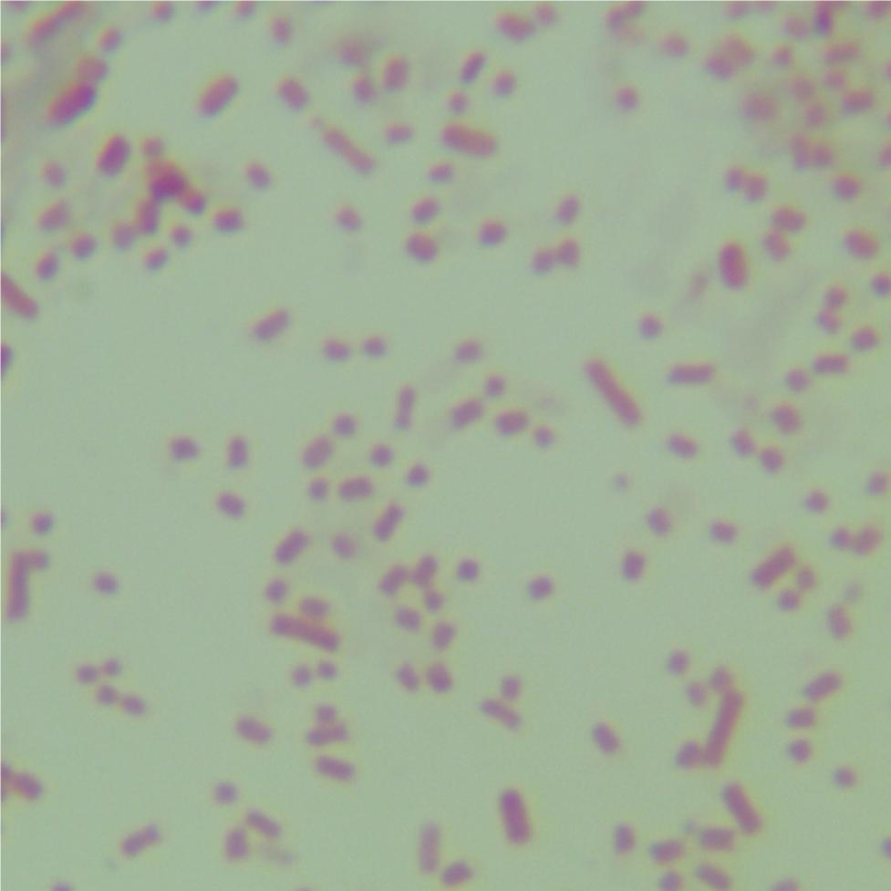 Enterotoxigenic Escherichia coli-BNCC