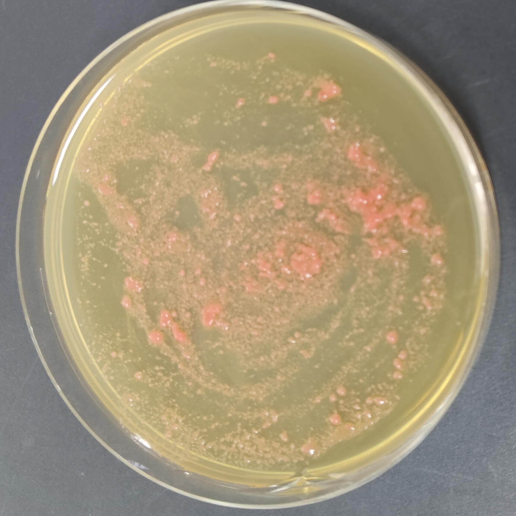 Rose colored microbacteria-BNCC