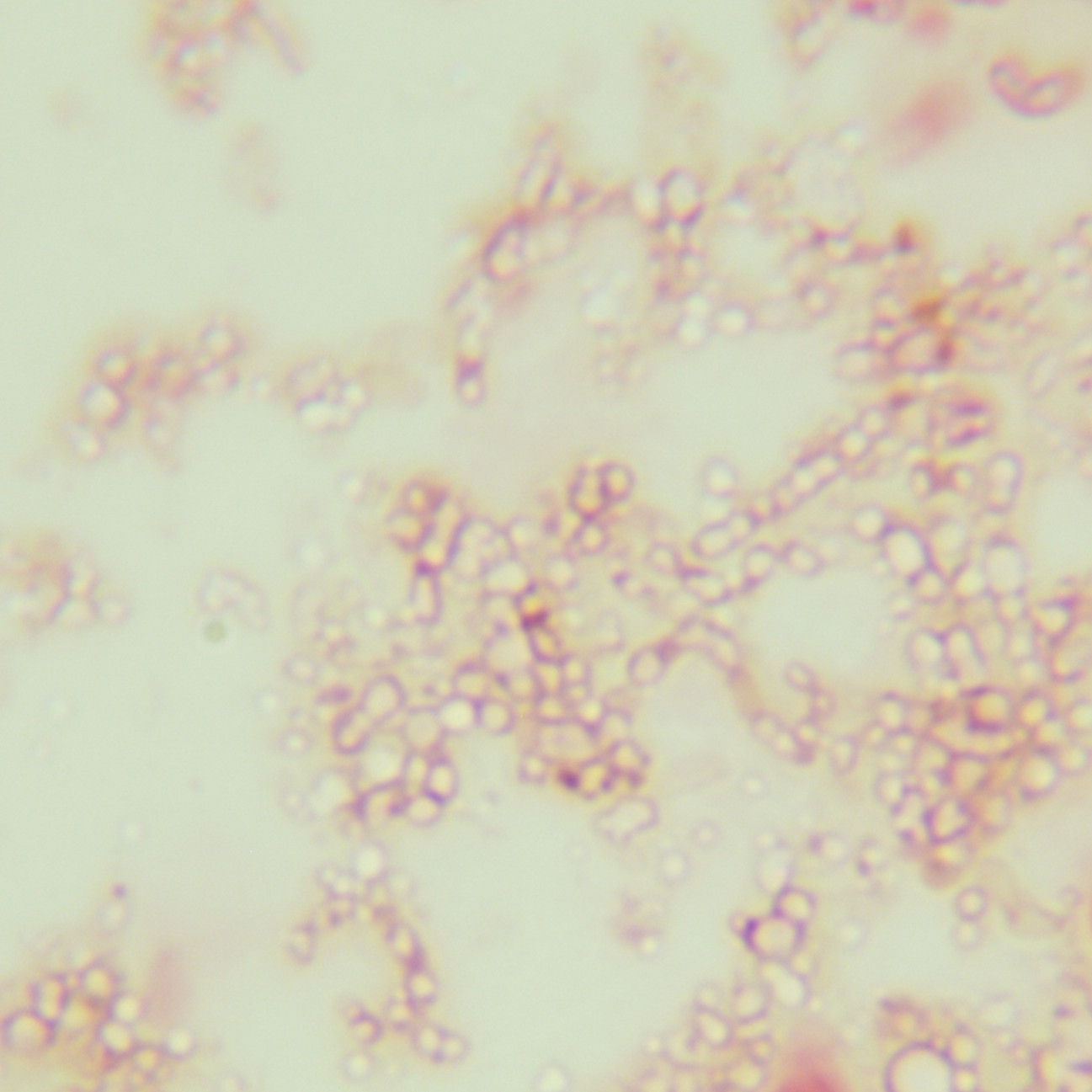 Rose colored microbacteria-BNCC
