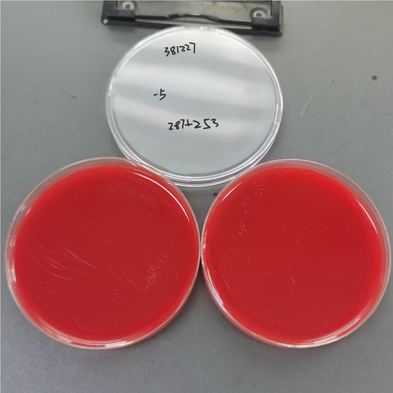 Helicobacter pylori-BNCC
