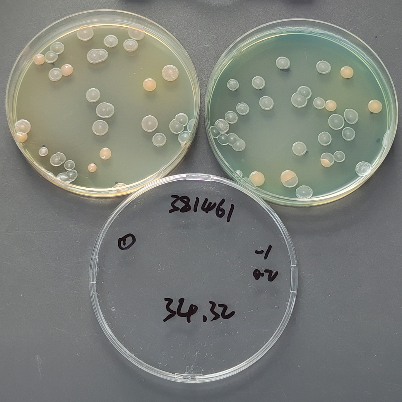 Quantitative strain of Pseudomonas aeruginosa-BNCC