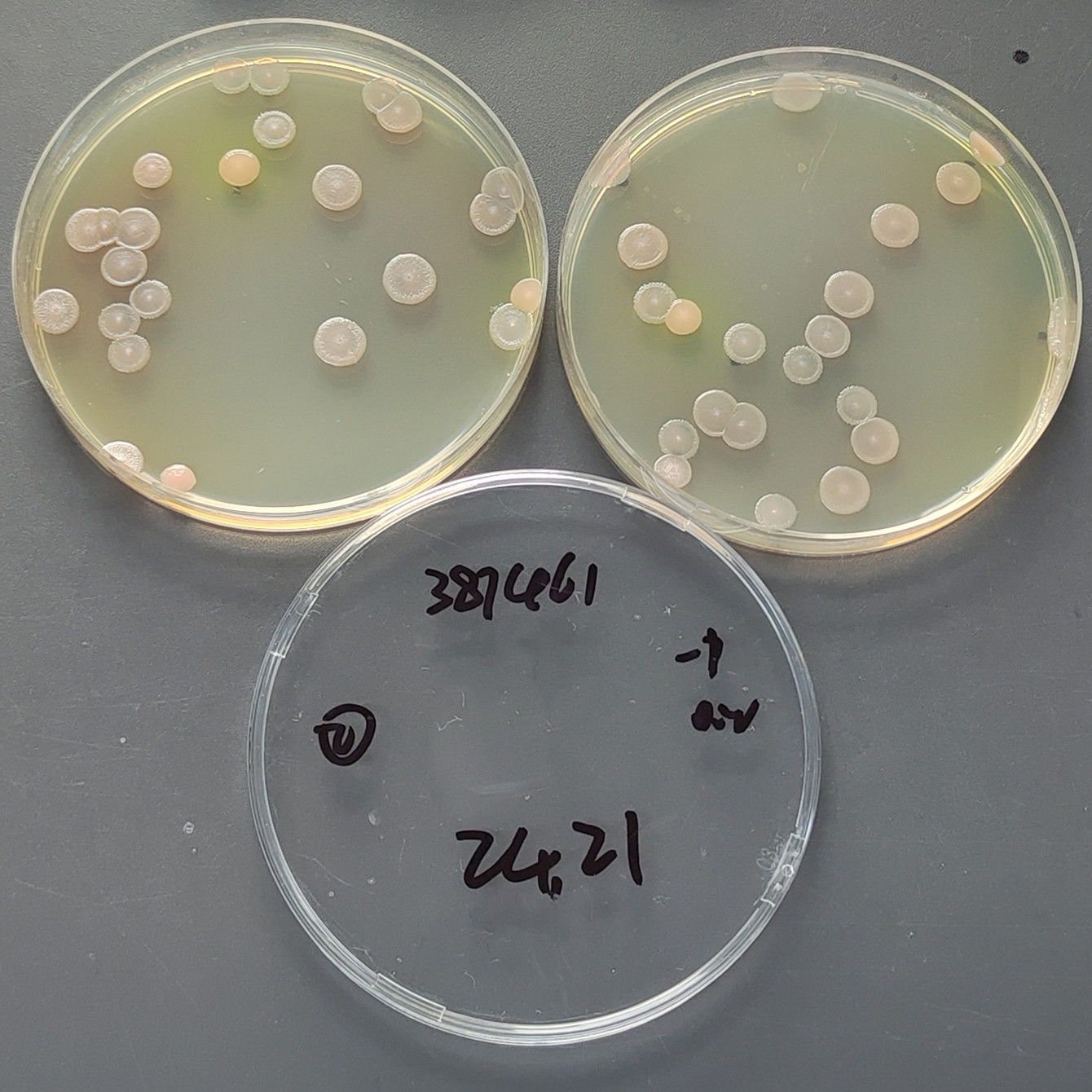 Quantitative strain of Pseudomonas aeruginosa-BNCC