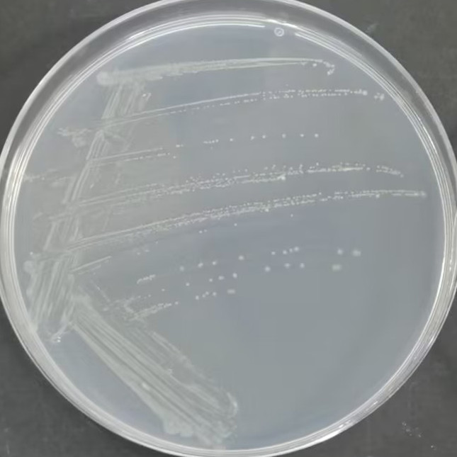 Histidine deficient Salmonella typhimurium TA1537-BNCC