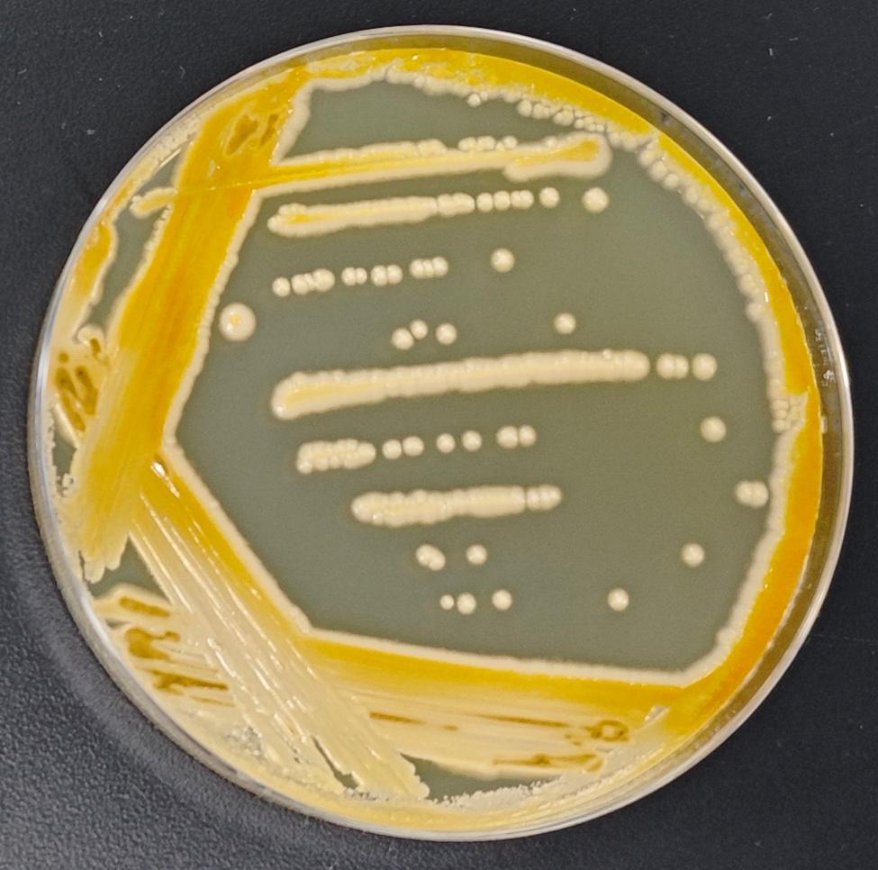 Short stem fungi genus-BNCC