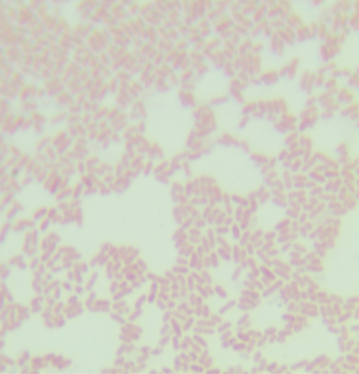 Burkholderia cepacia-BNCC