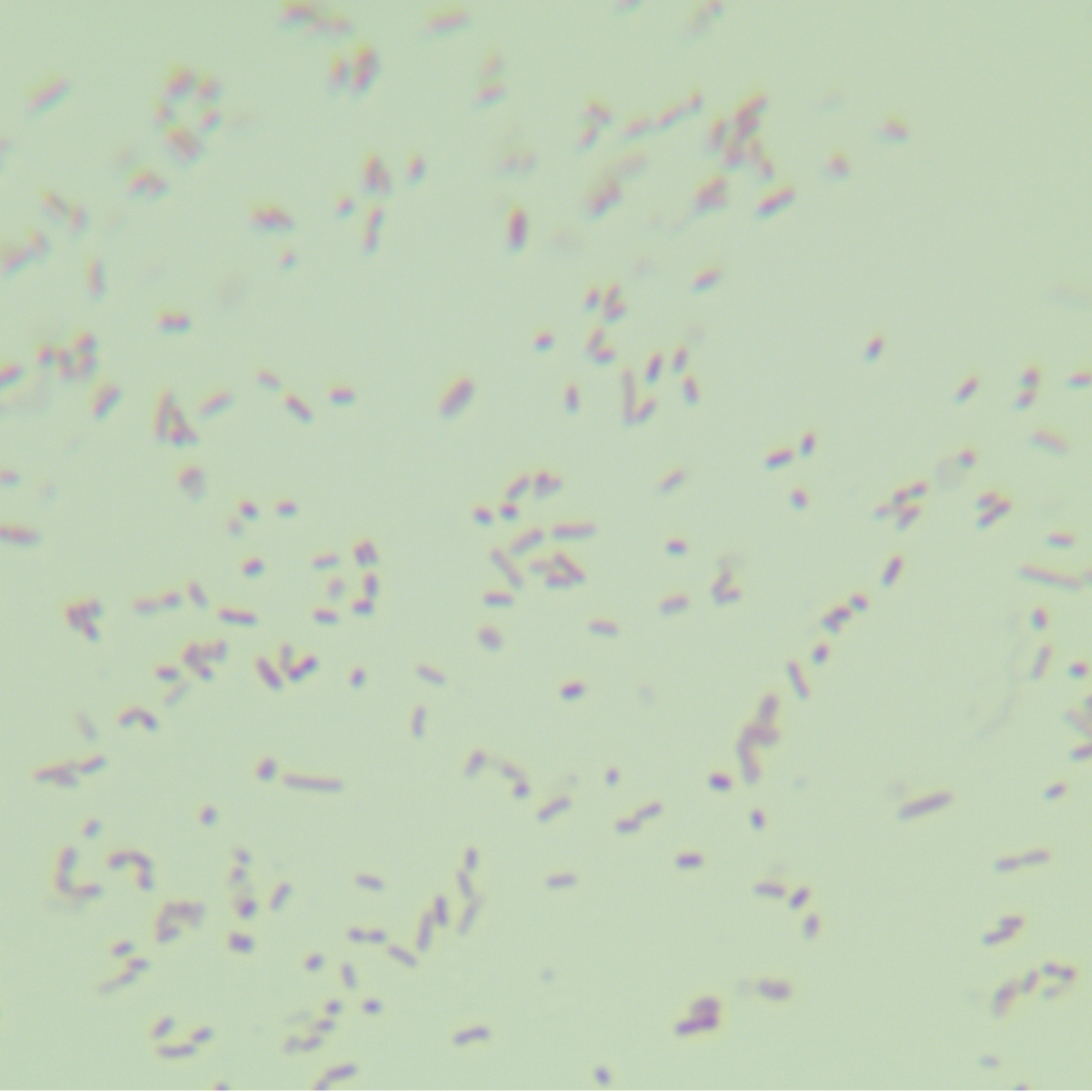 Oral Hoylesella-BNCC