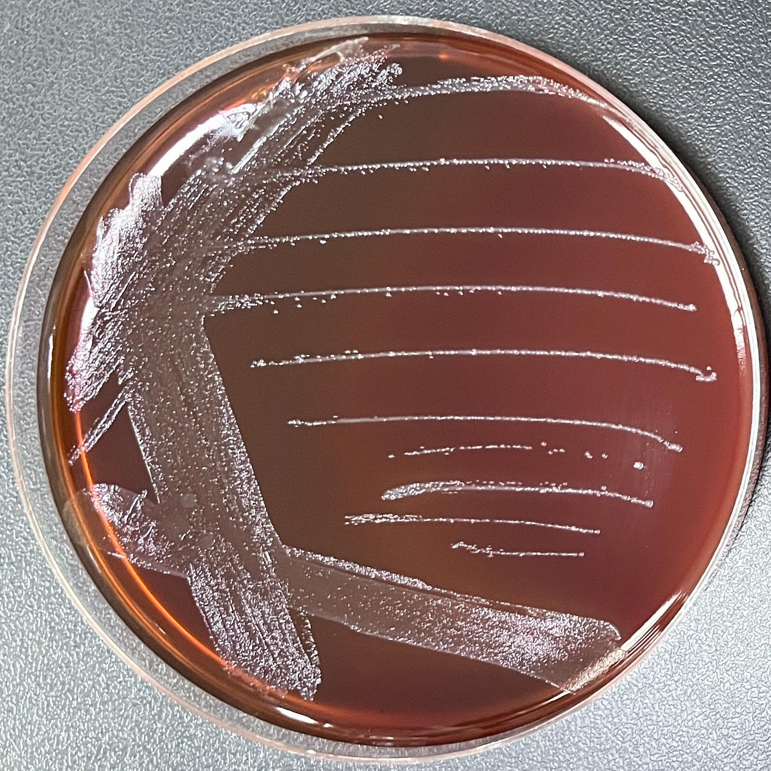 Oral Hoylesella-BNCC
