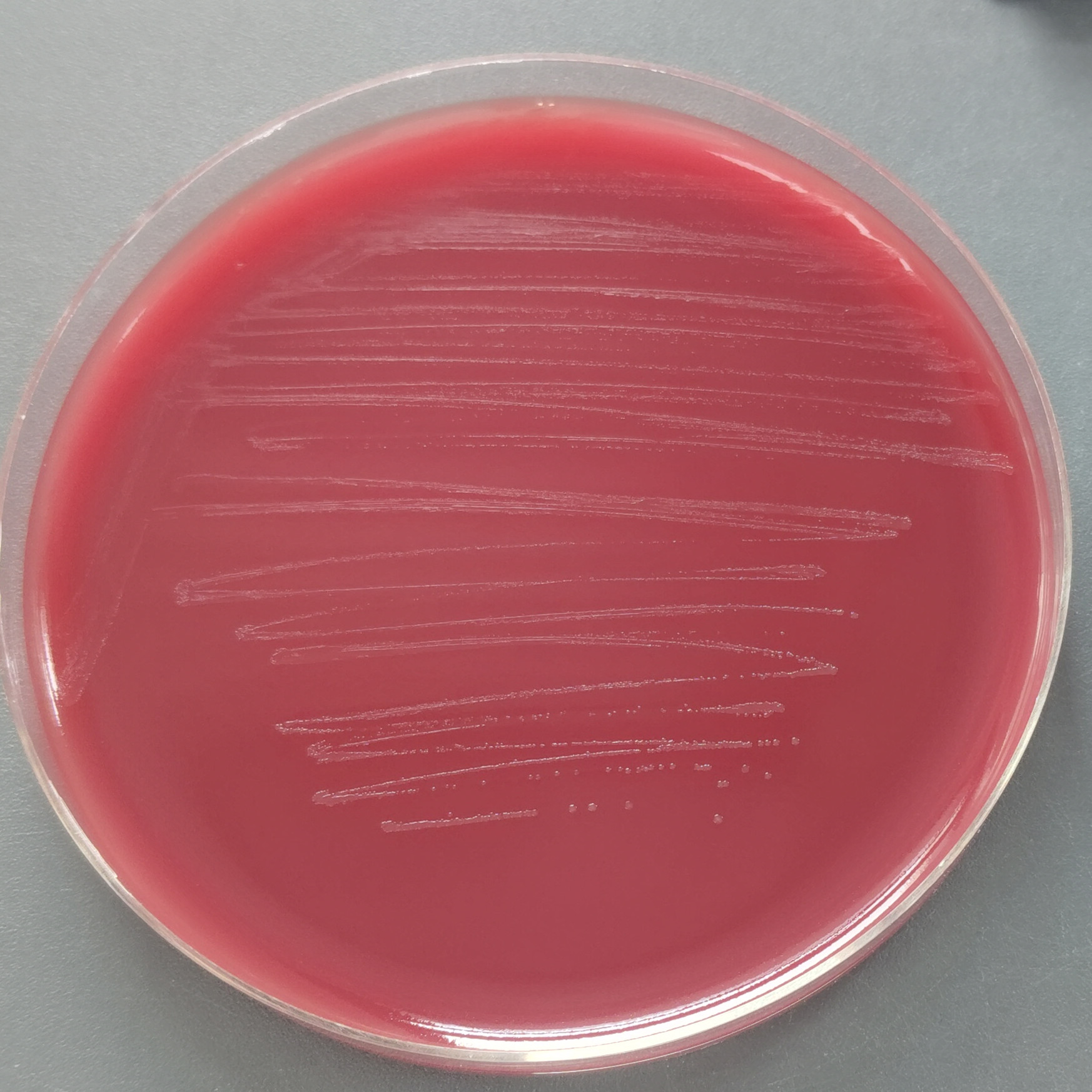 Reduction of Fusarium graminearum-BNCC
