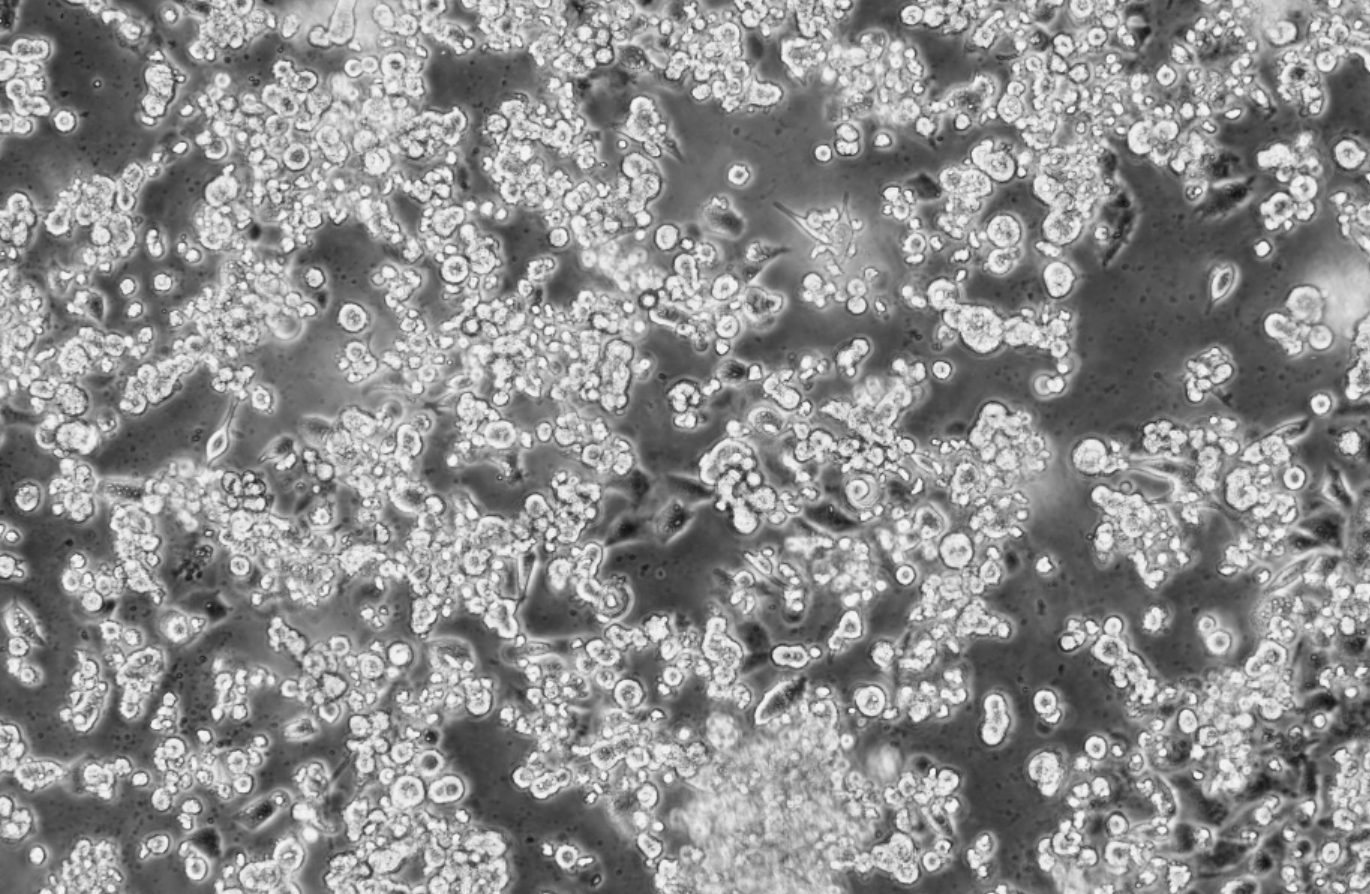 Human herpesvirus type 3 DNA standard (varicella zoster virus)-BNCC