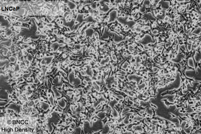 Human prostate cancer cells-BNCC