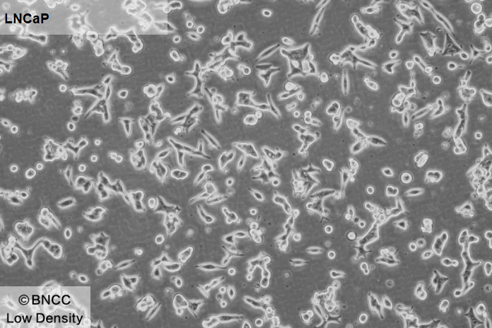 Human prostate cancer cells-BNCC