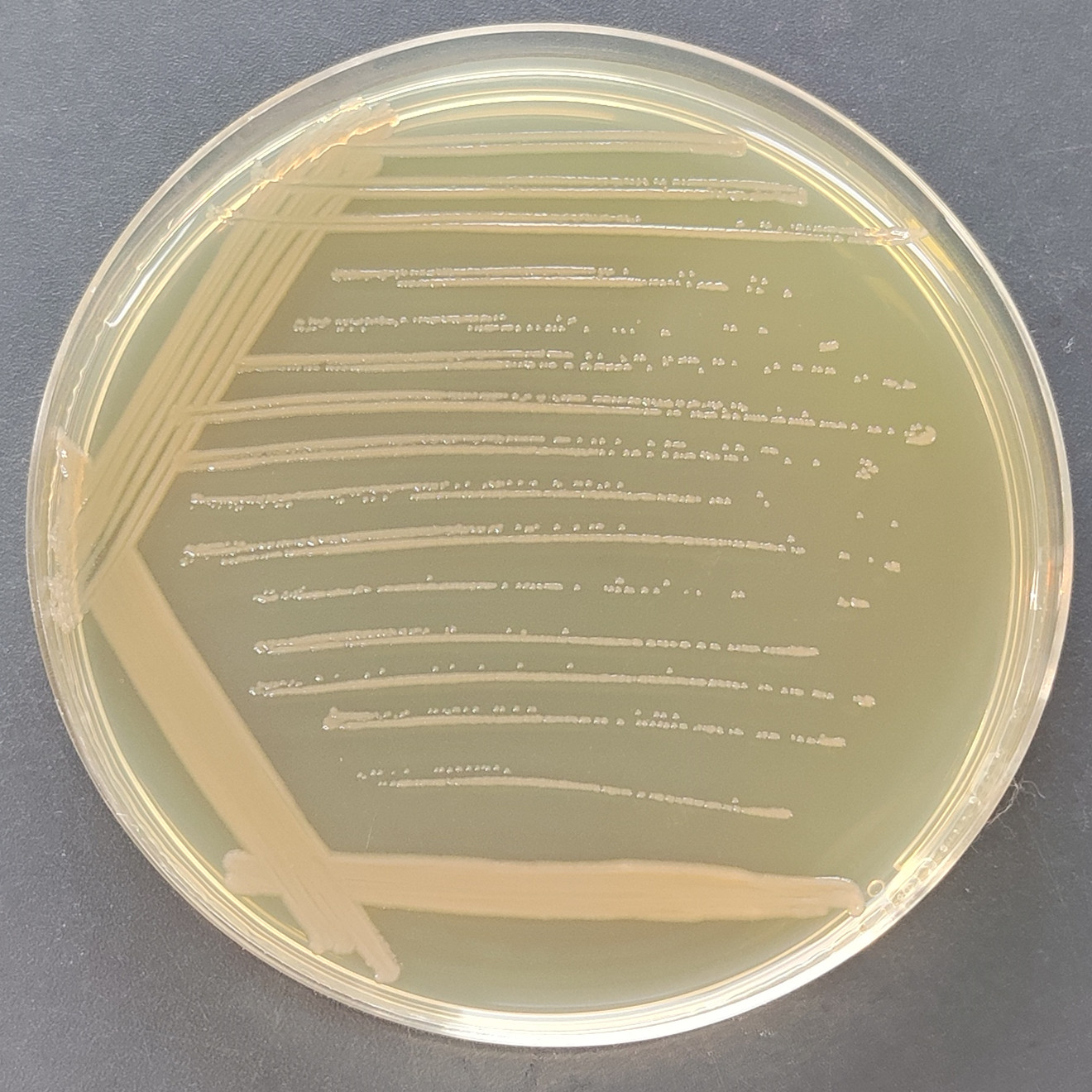 Pseudomonas aeruginosa-BNCC
